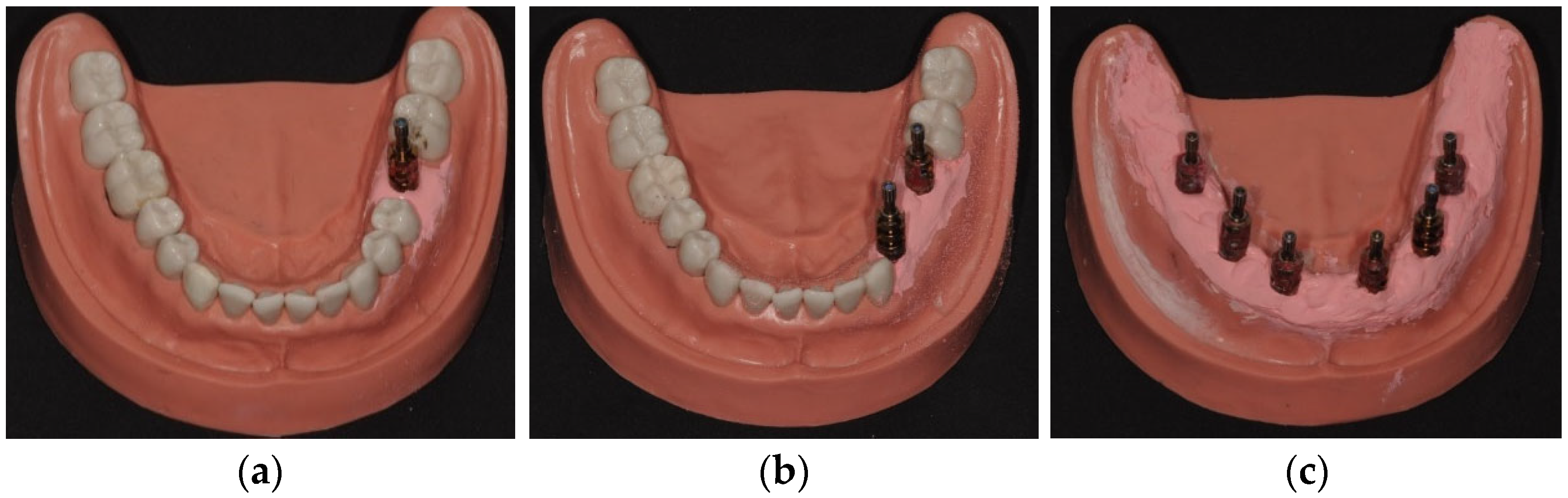 Dentistry 12 00340 g001