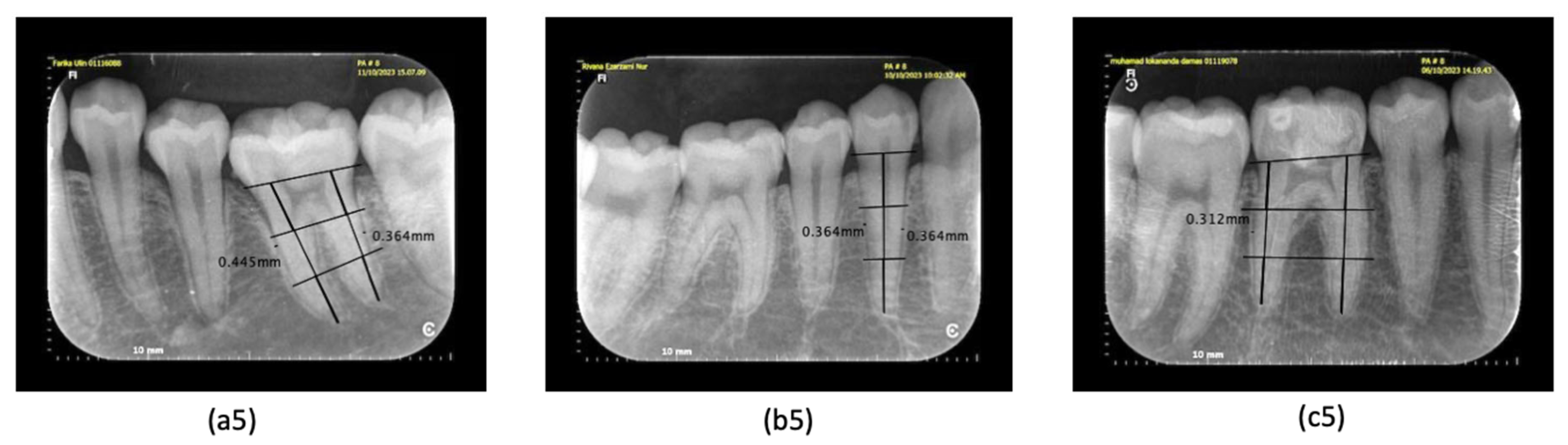 Dentistry 12 00407 g003