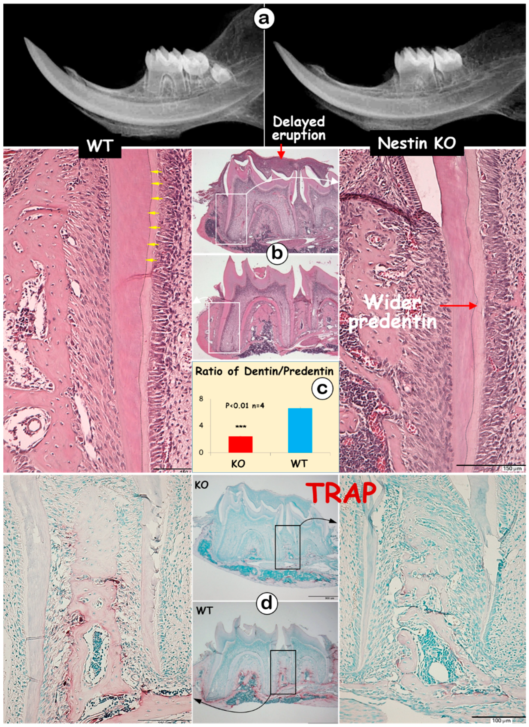 Dentistry 13 00113 g002 Dentistry 13 00113 g002