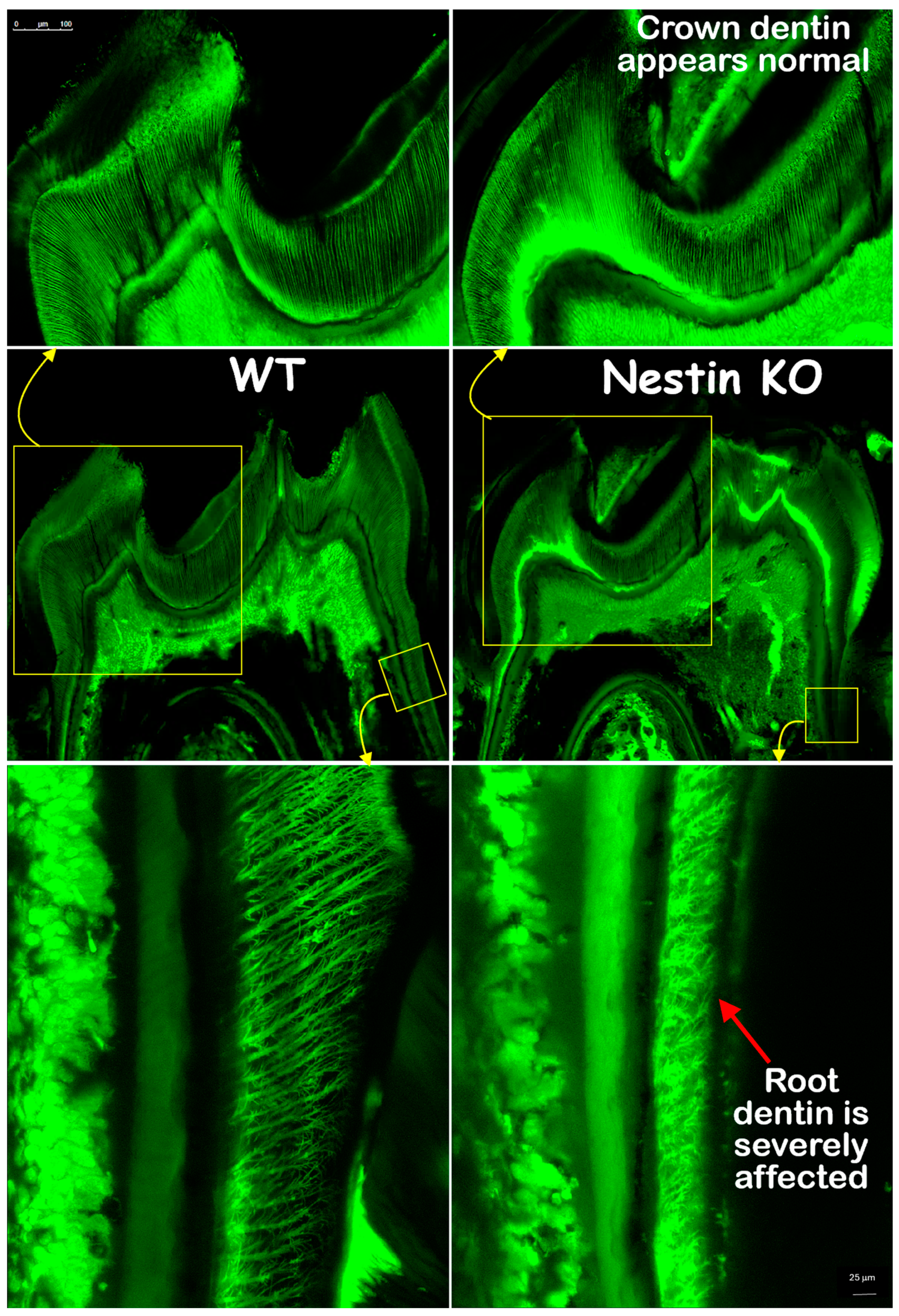 Dentistry 13 00113 g005 Dentistry 13 00113 g005