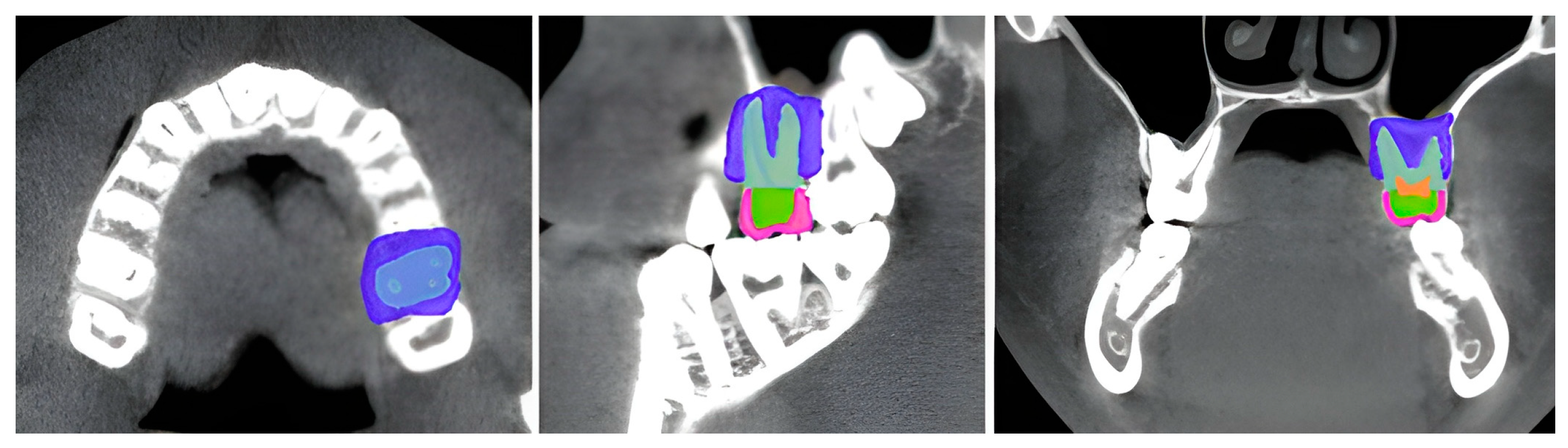 Dentistry 13 00137 g001