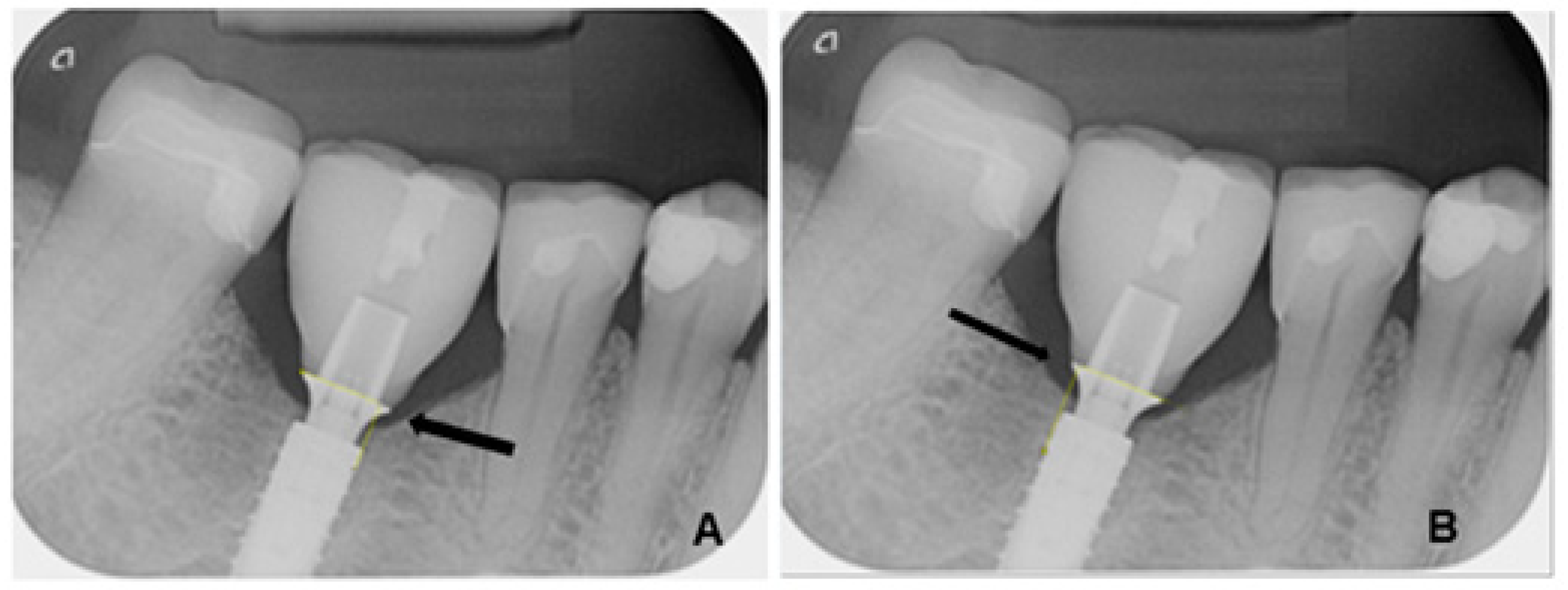 Dentistry 13 00430 g001 Dentistry 13 00430 g001