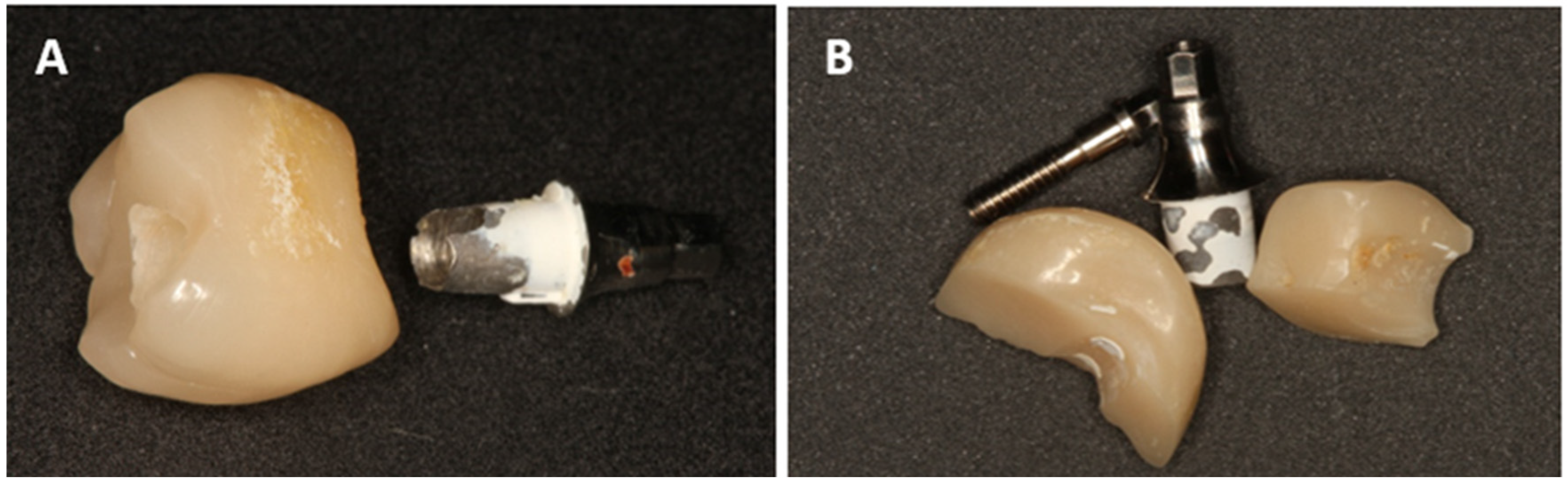 Dentistry 13 00430 g002 Dentistry 13 00430 g002