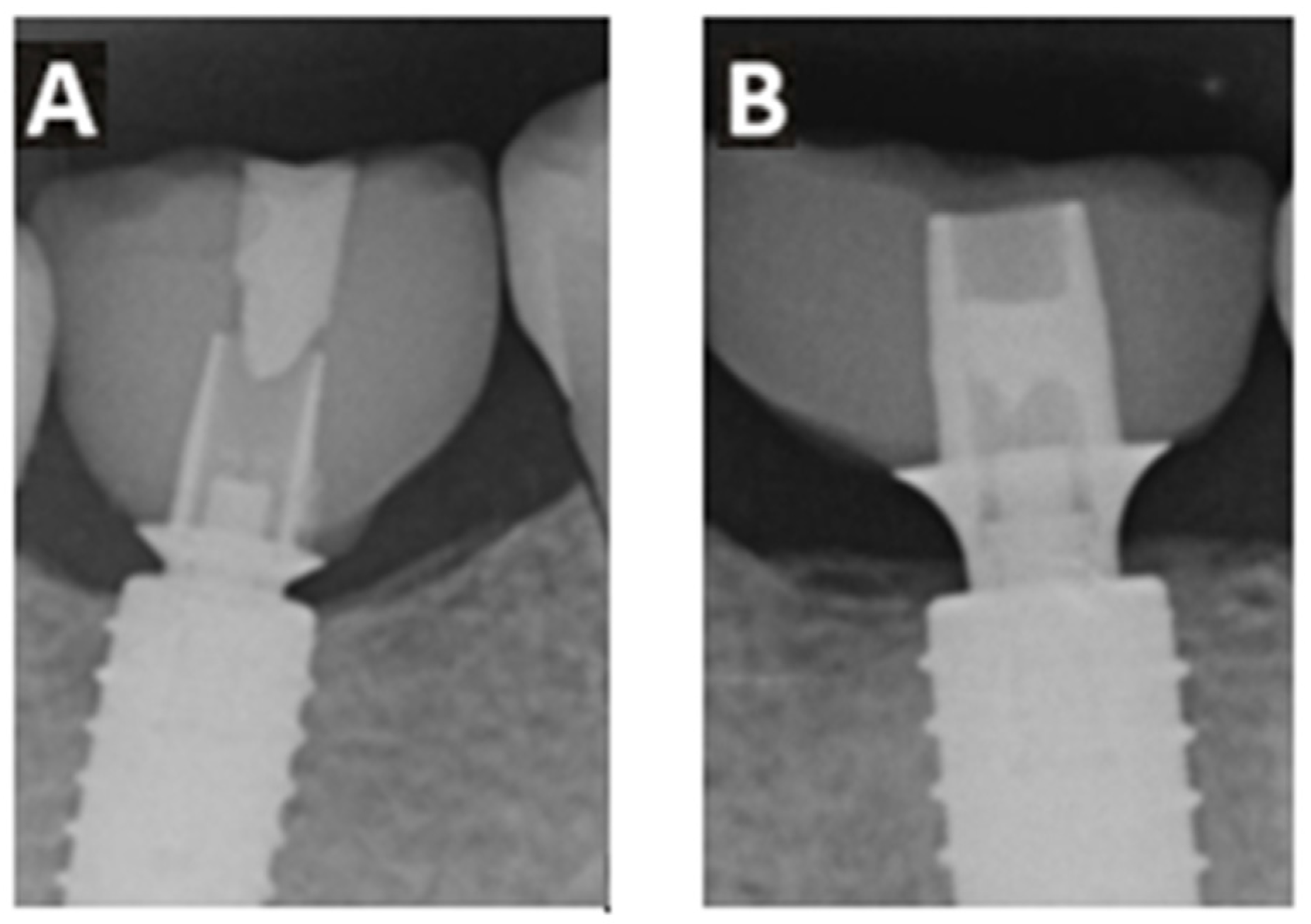 Dentistry 13 00430 g004 Dentistry 13 00430 g004