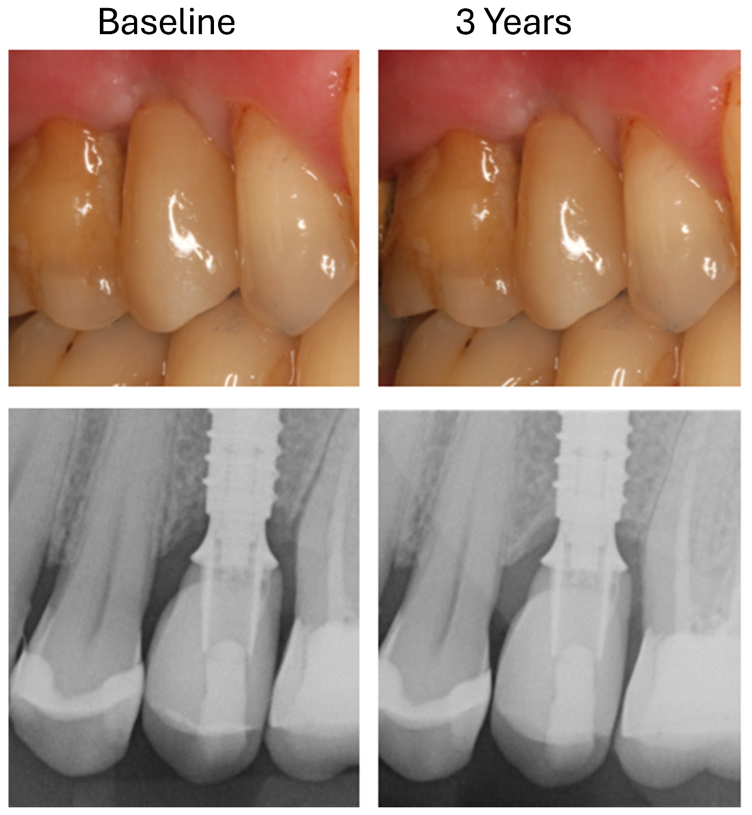 Dentistry 13 00430 g005 Dentistry 13 00430 g005