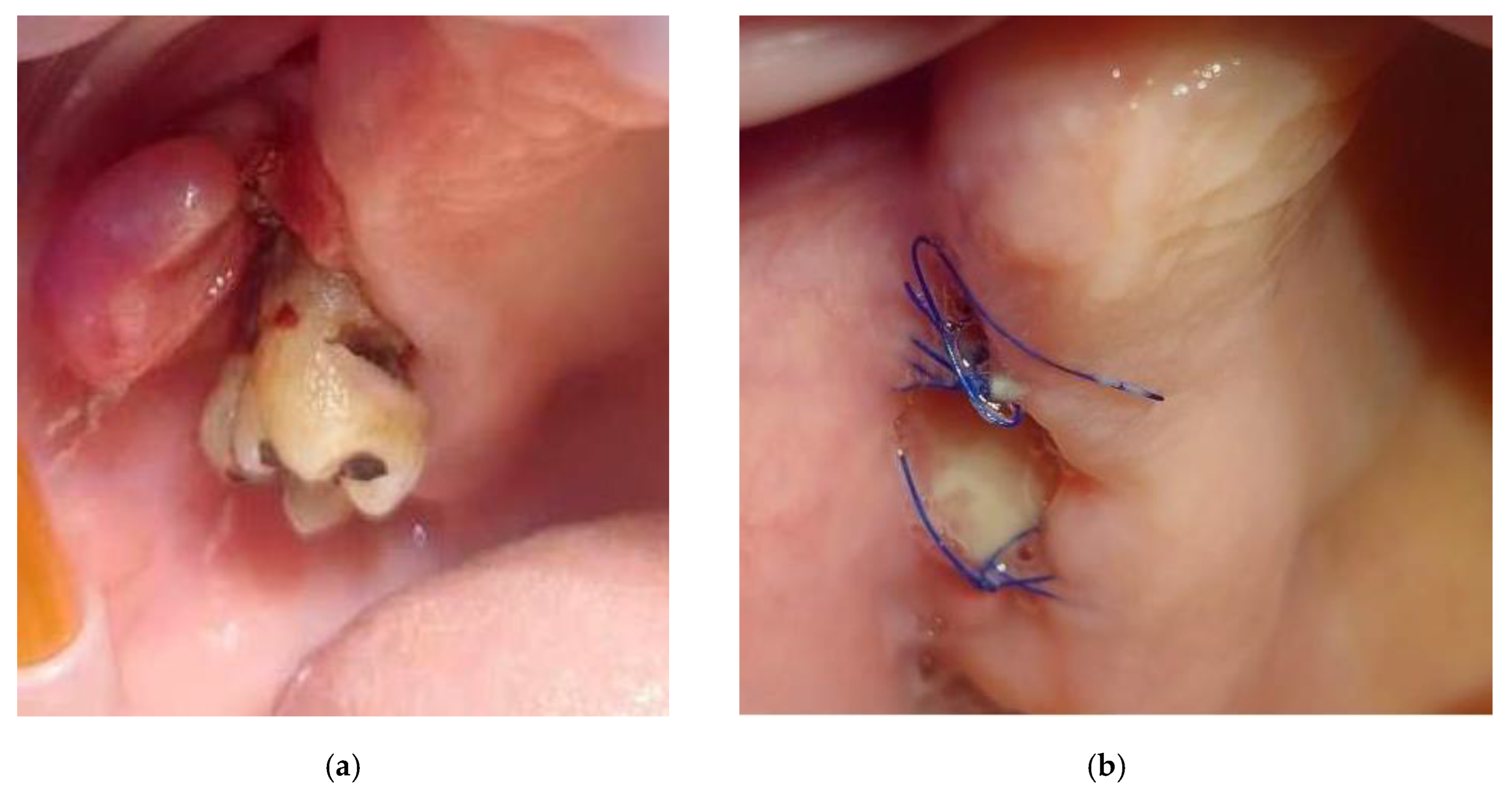 Dentistry 13 00432 g001 Dentistry 13 00432 g001