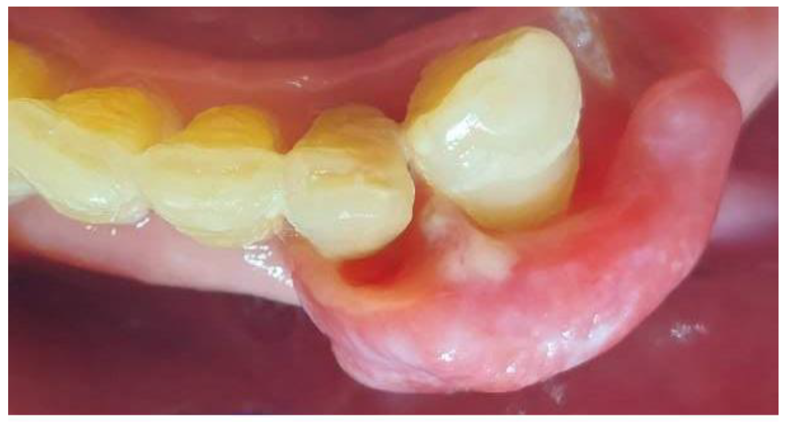 Dentistry 13 00432 g002 Dentistry 13 00432 g002