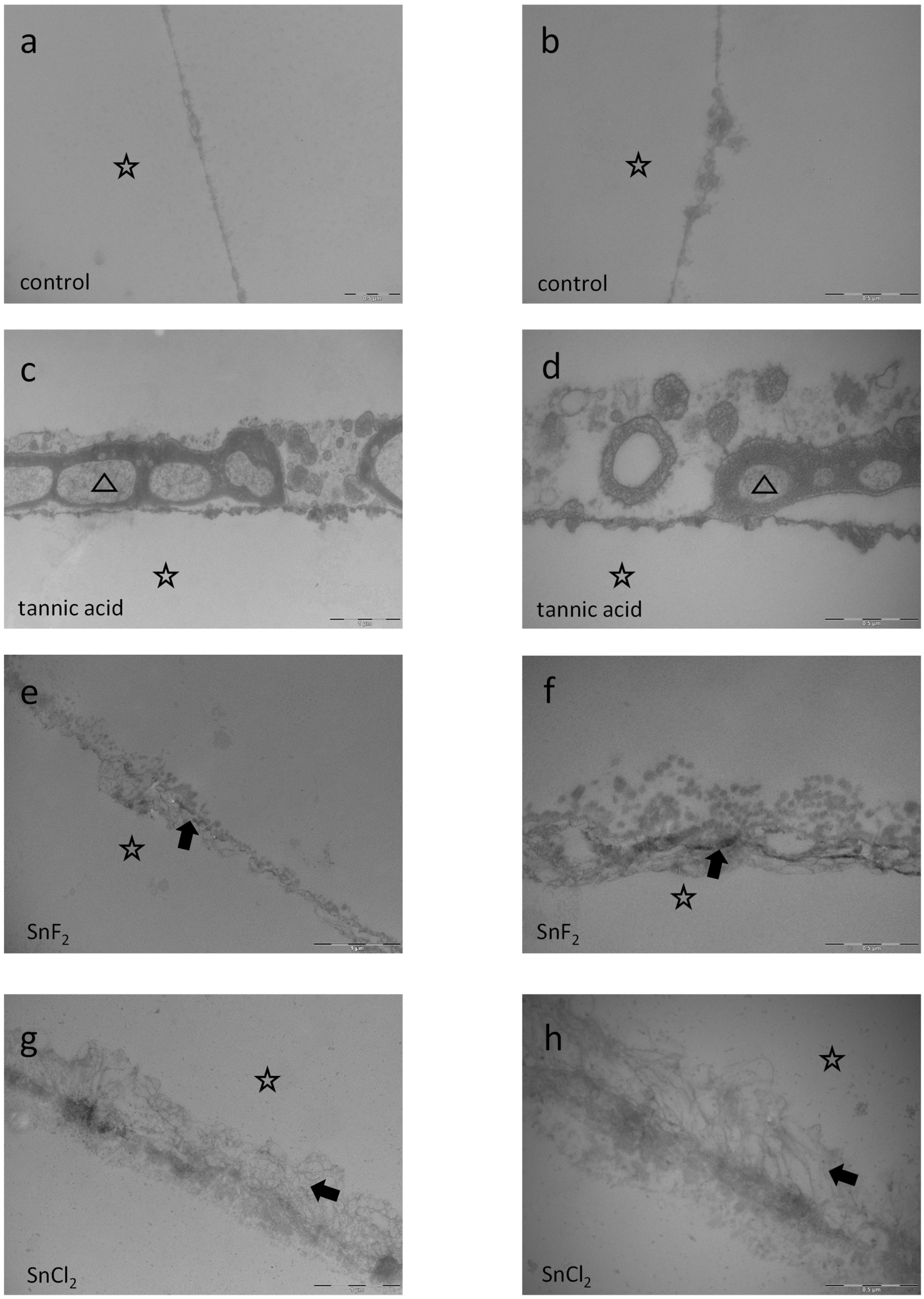 Dentistry 13 00442 g014 Dentistry 13 00442 g014