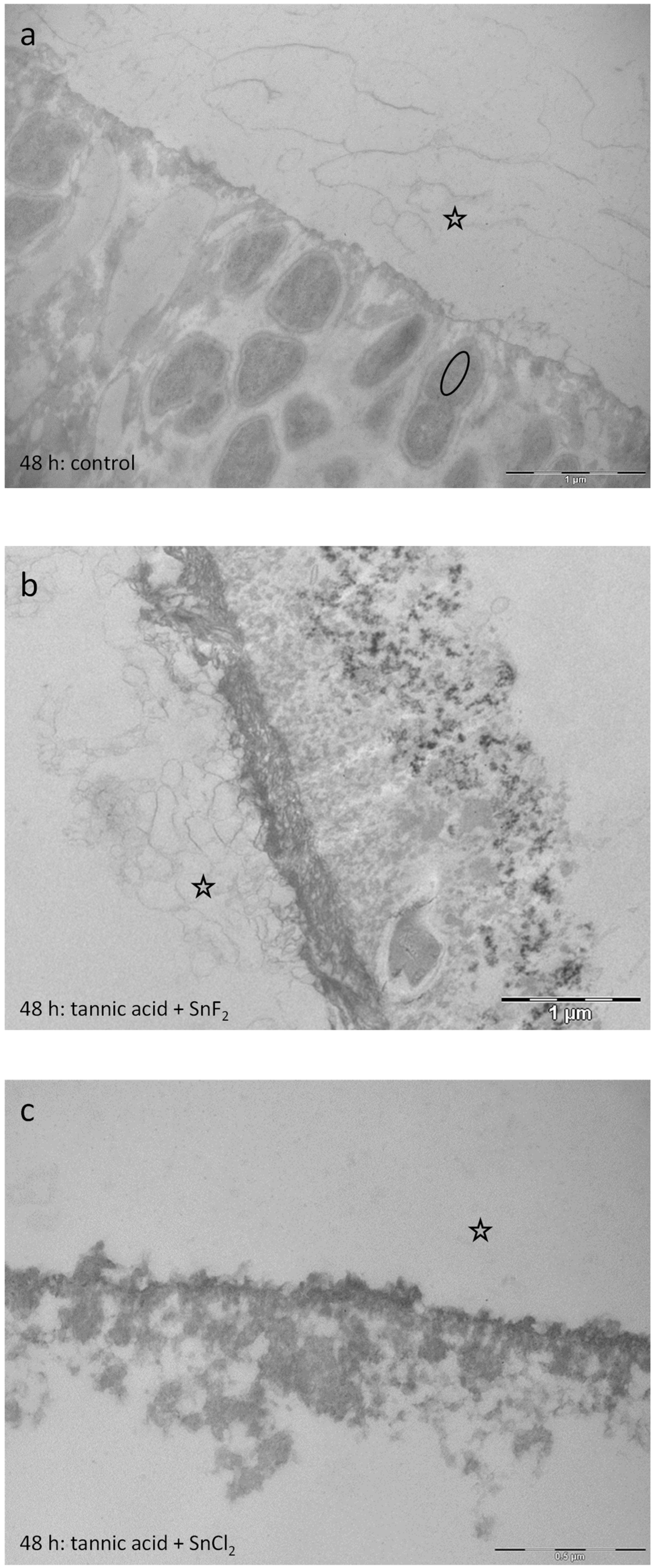 Dentistry 13 00442 g017 Dentistry 13 00442 g017