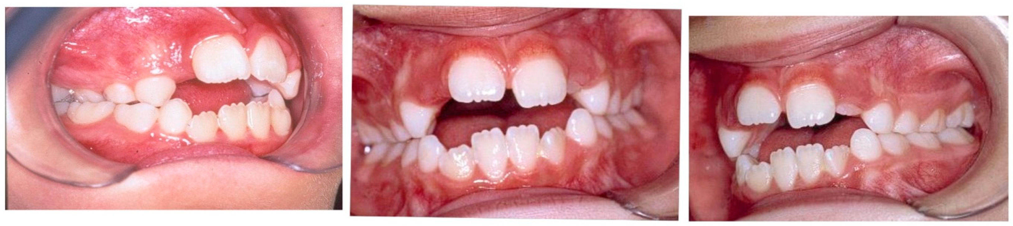 Dentistry 14 00055 g002 Dentistry 14 00055 g002