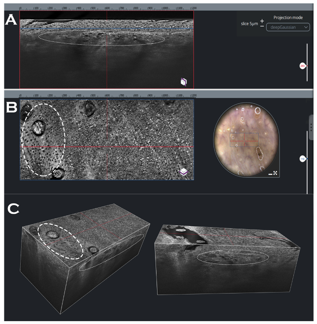 Dermato 03 00013 g006 Dermato 03 00013 g006
