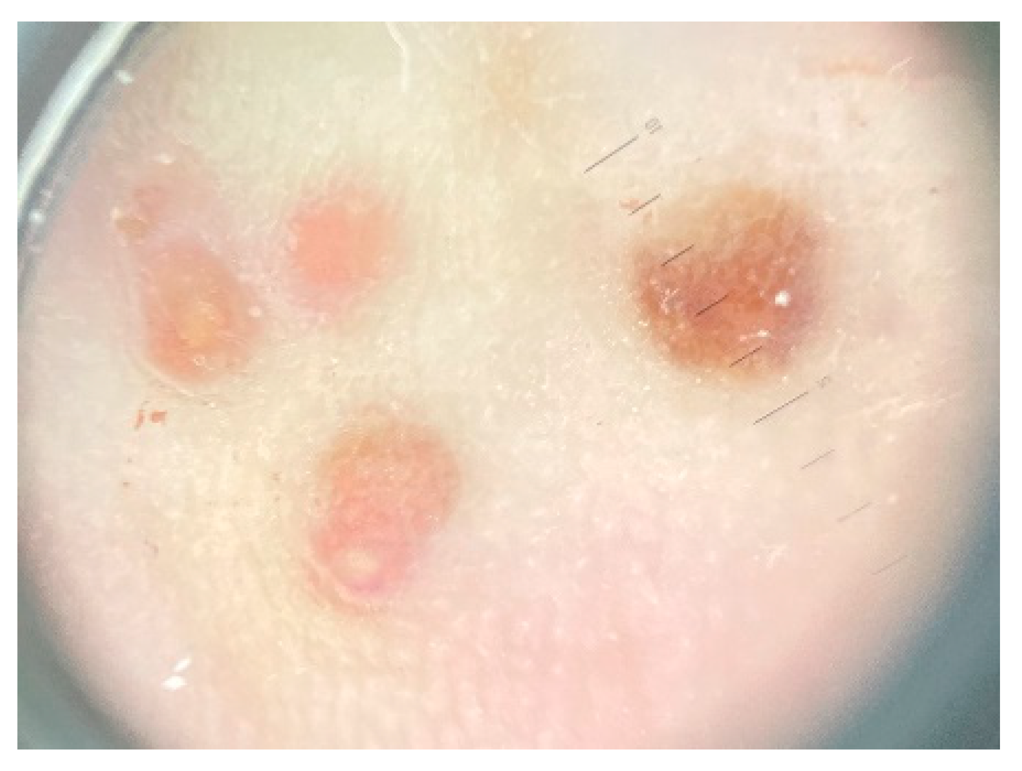 Dermato 04 00008 g002 Dermato 04 00008 g002