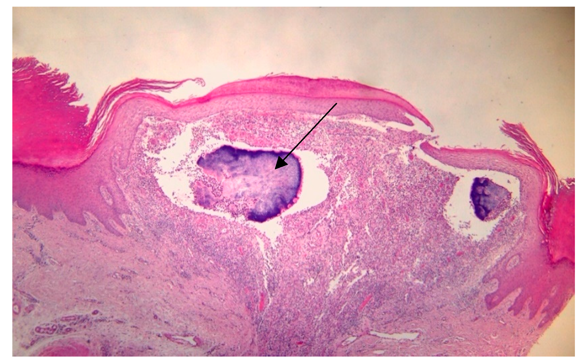 Dermato 04 00008 g004 Dermato 04 00008 g004