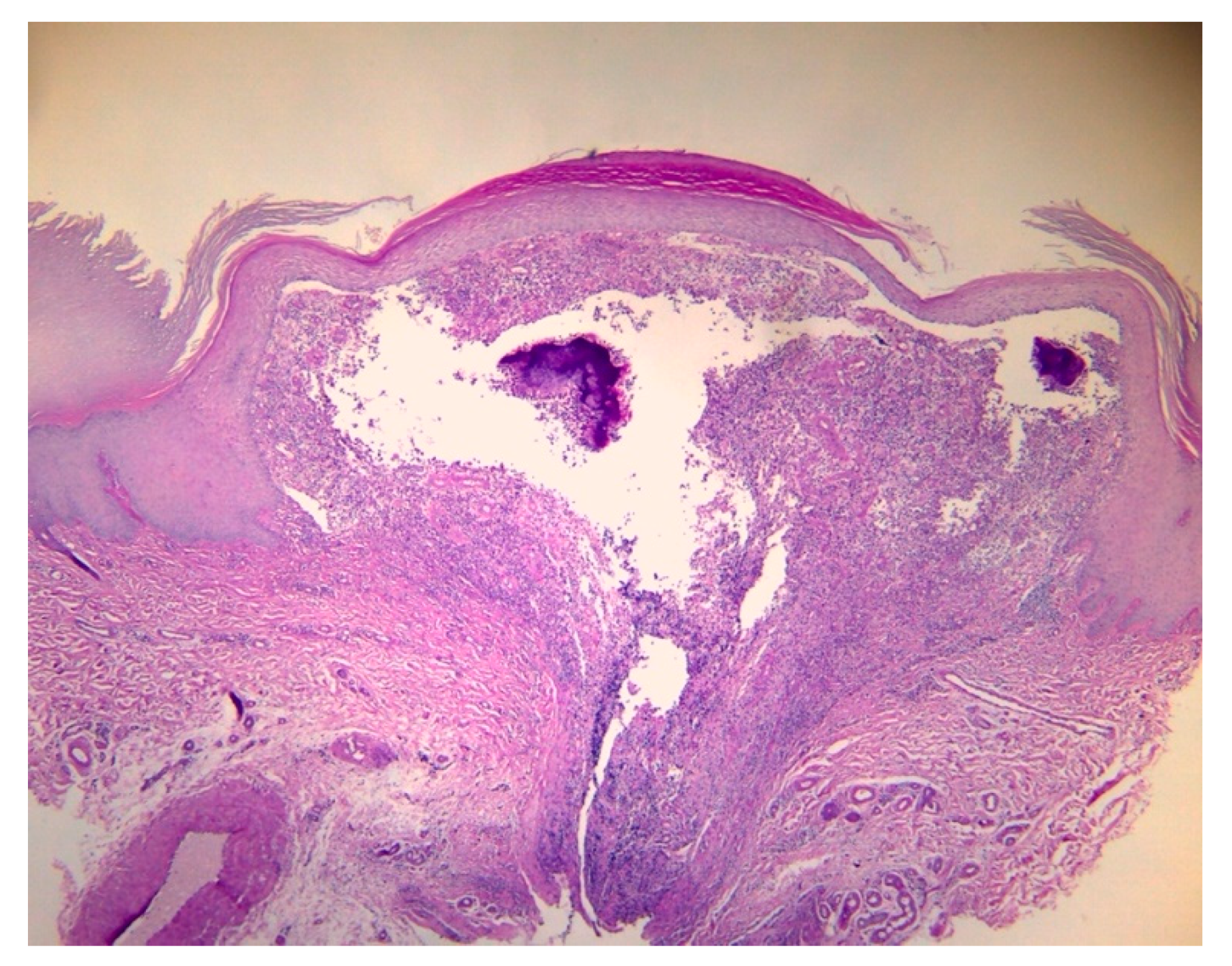 Dermato 04 00008 g005 Dermato 04 00008 g005