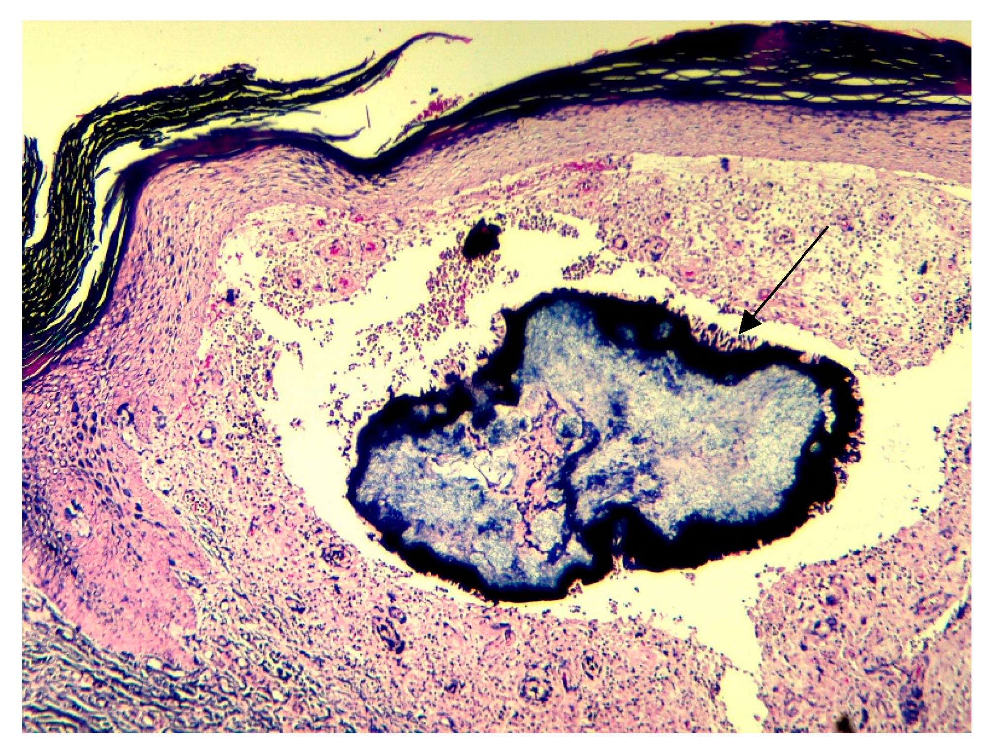 Dermato 04 00008 g006 Dermato 04 00008 g006