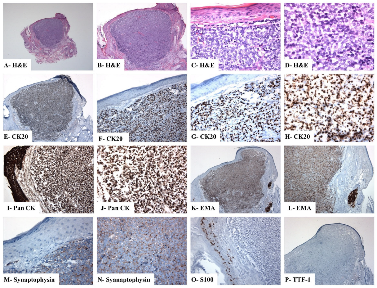 Dermato 06 00004 g002 Dermato 06 00004 g002