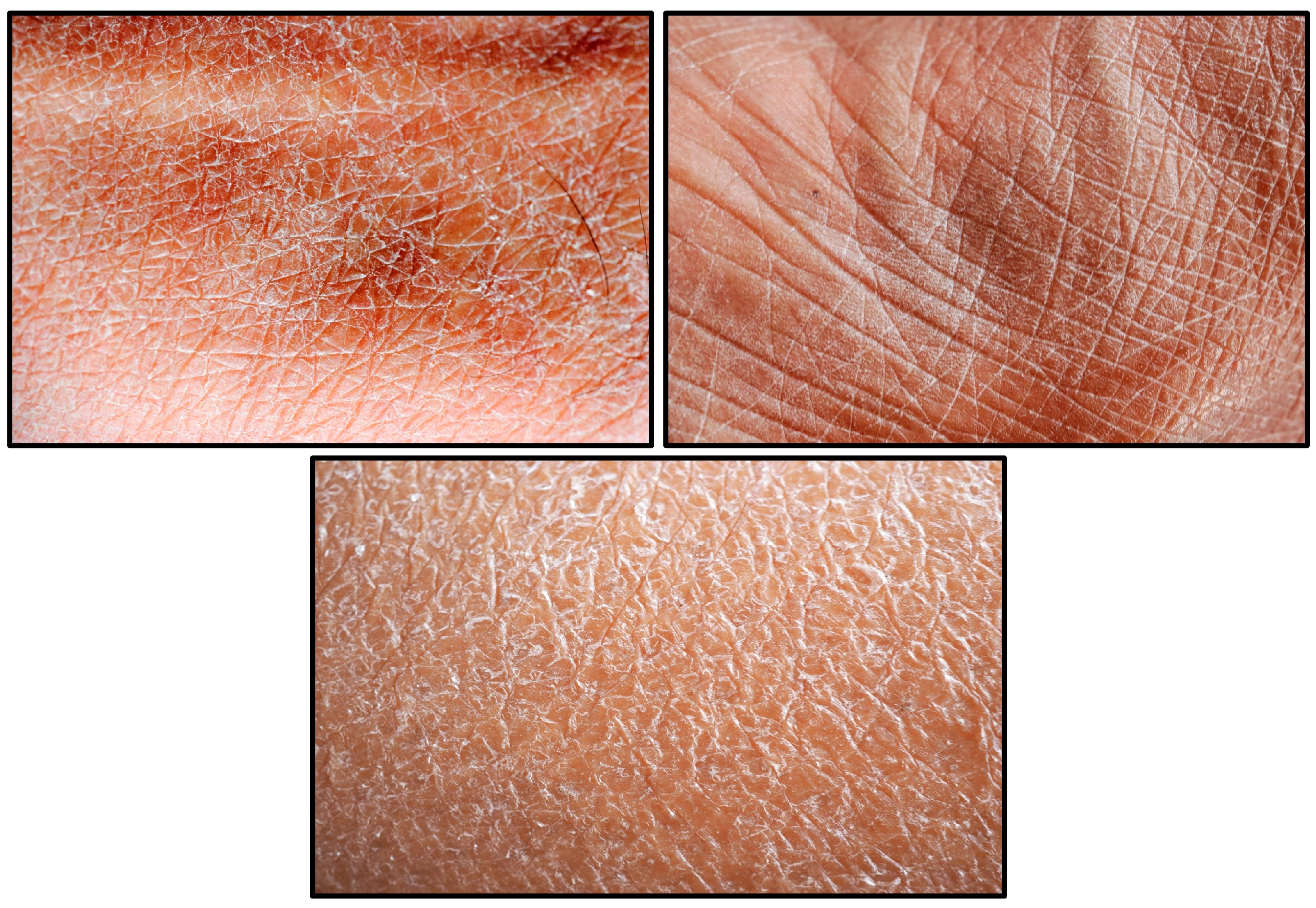 Dermato 06 00016 g003 Dermato 06 00016 g003