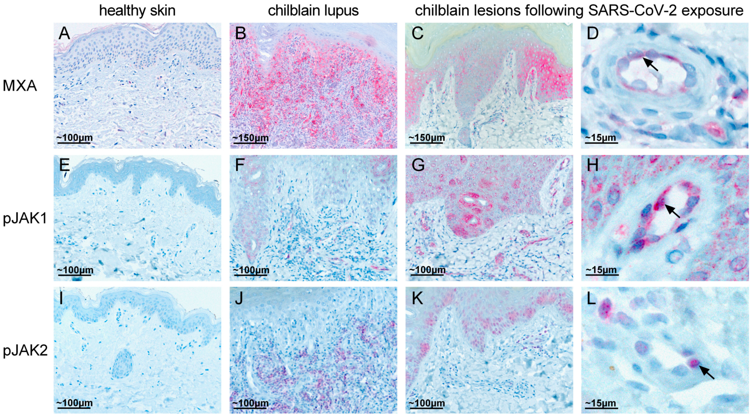 Dermatopathology 07 00010 g003 Dermatopathology 07 00010 g003