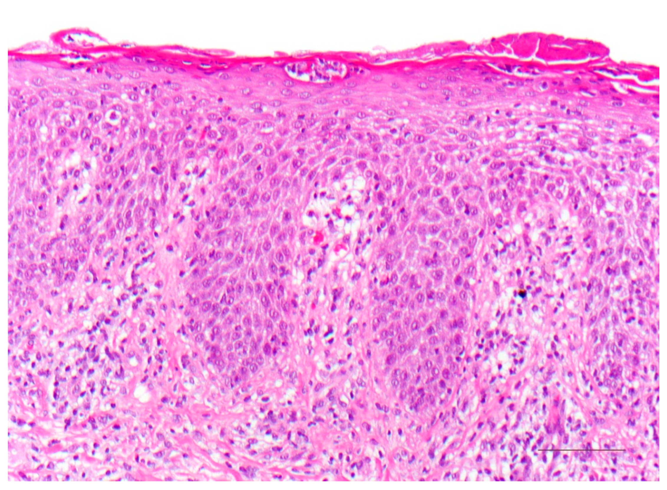 Dermatopathology 08 00017 g013 Dermatopathology 08 00017 g013