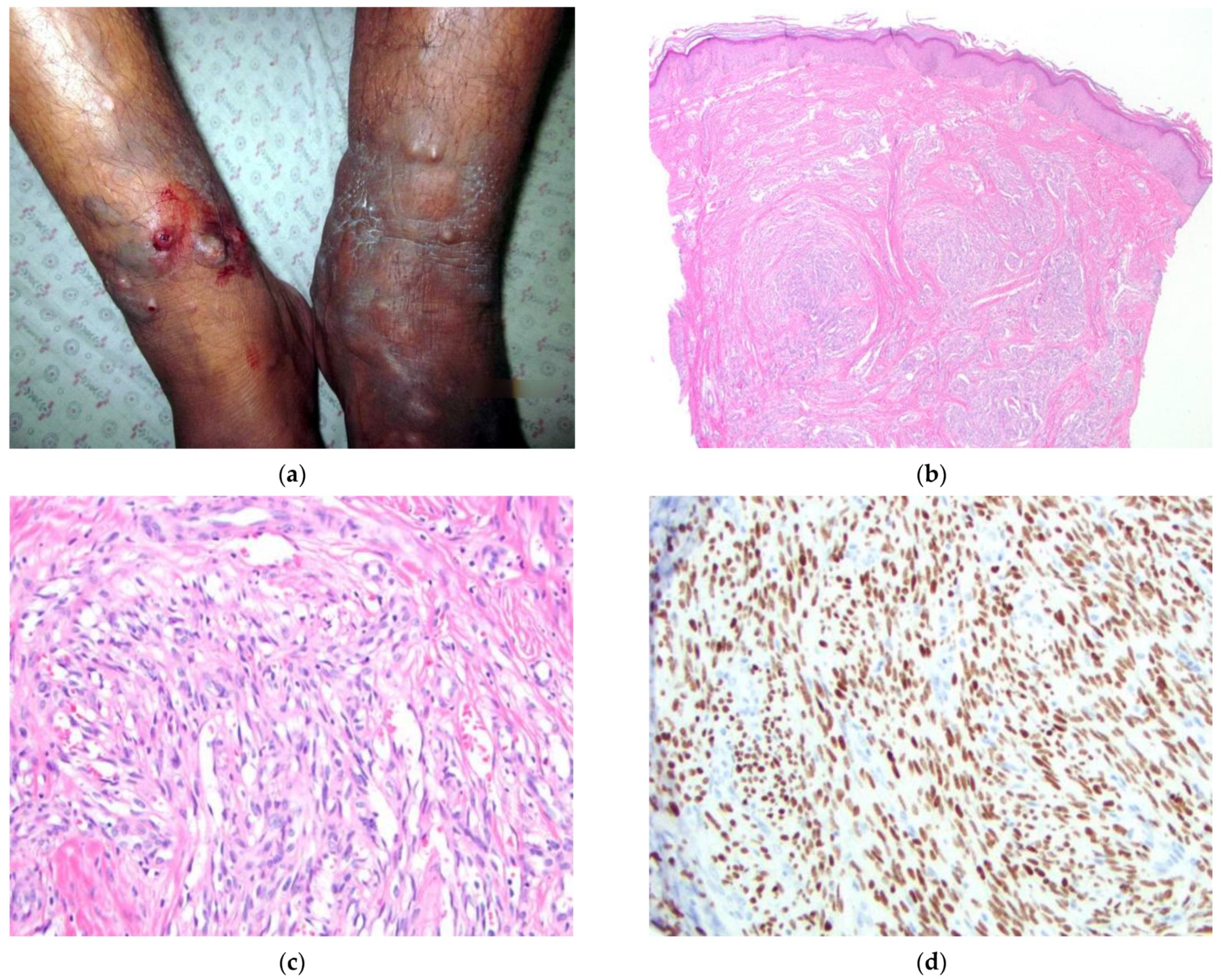 Dermatopathology 09 00030 g002 Dermatopathology 09 00030 g002