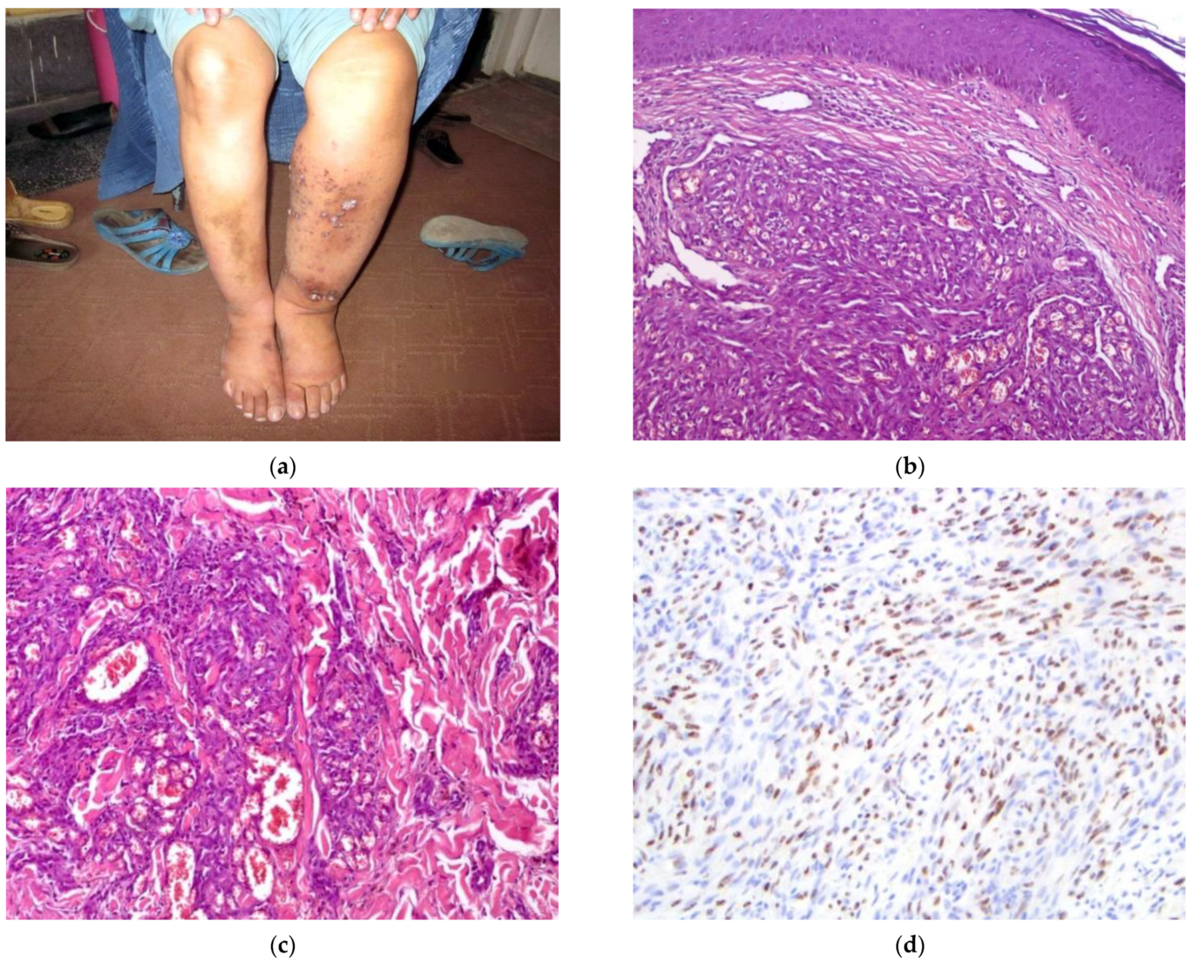 Dermatopathology 09 00030 g003 Dermatopathology 09 00030 g003
