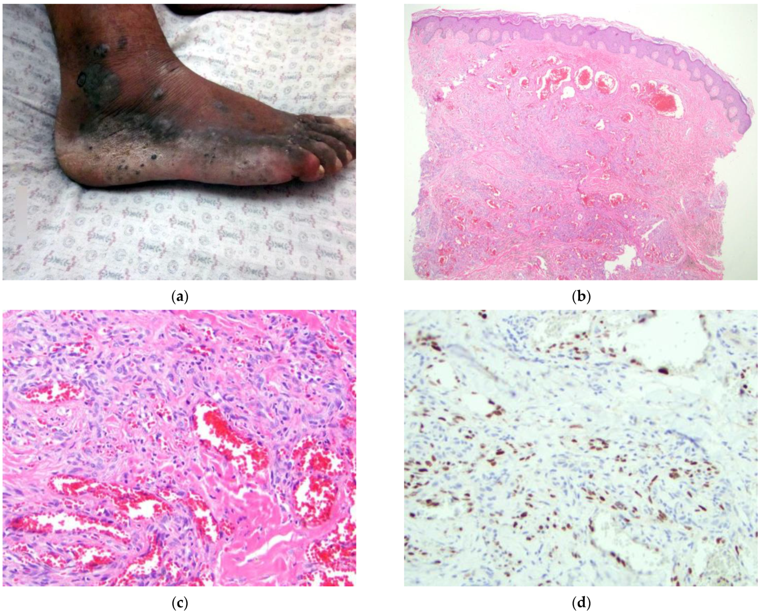 Dermatopathology 09 00030 g005 Dermatopathology 09 00030 g005