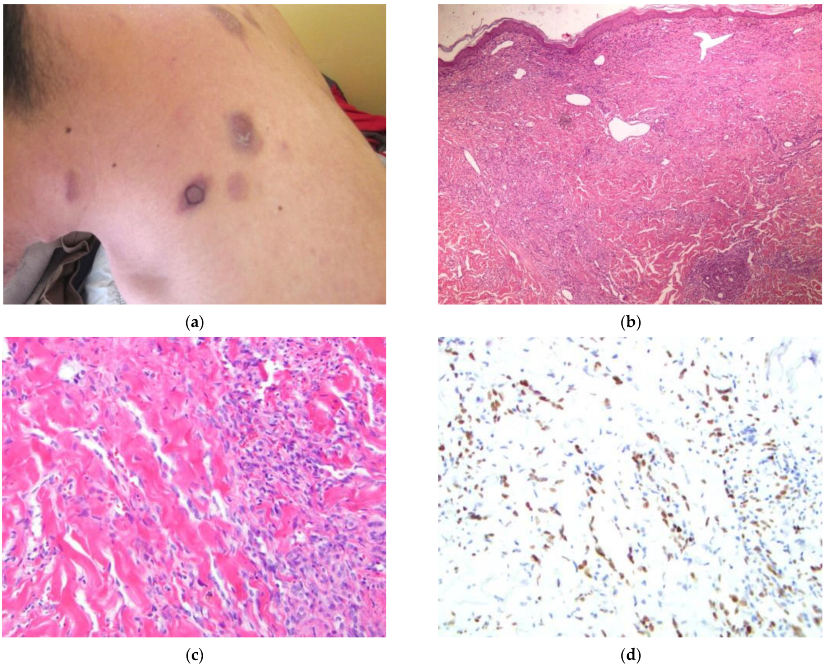 Dermatopathology 09 00030 g006 Dermatopathology 09 00030 g006