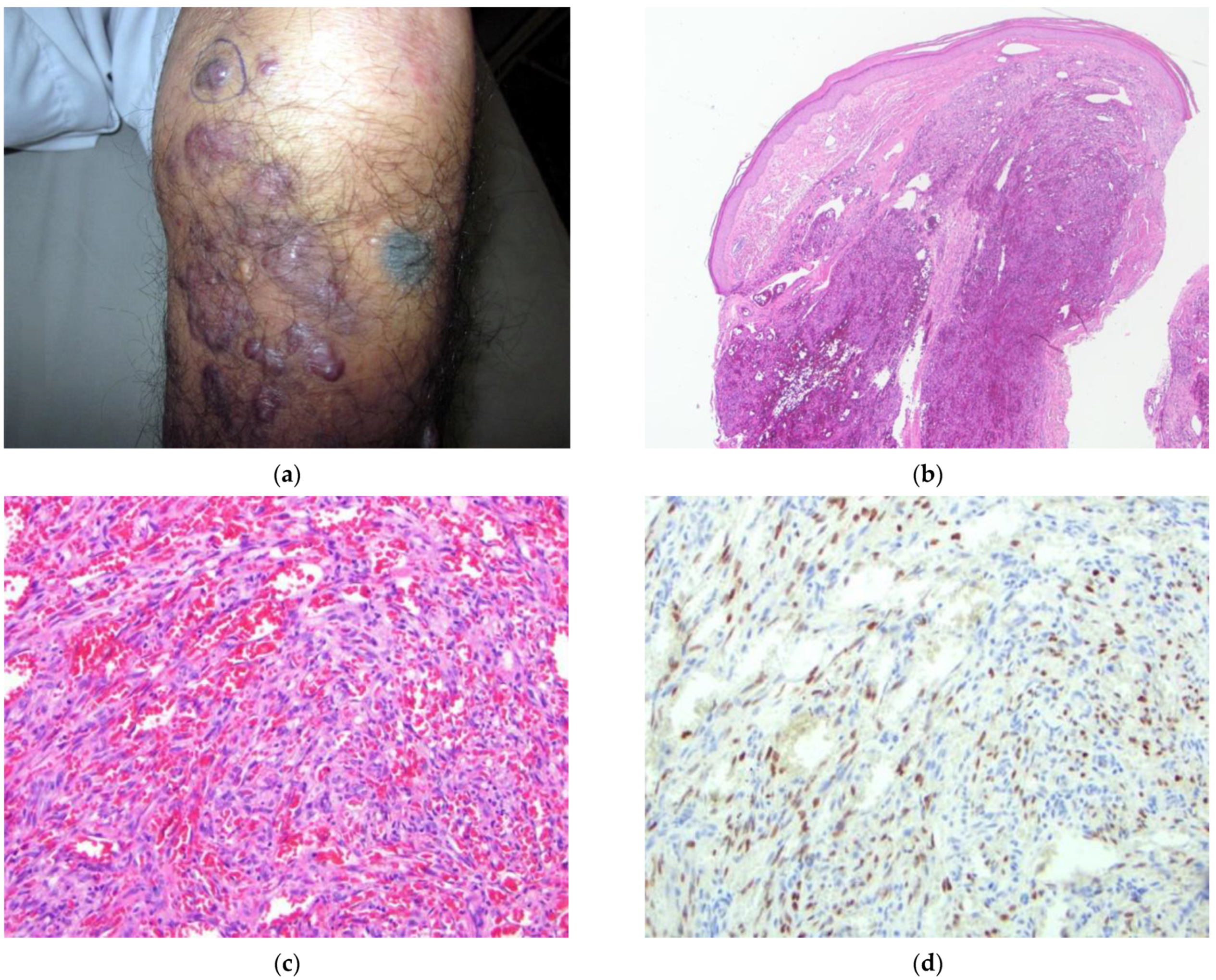 Dermatopathology 09 00030 g007 Dermatopathology 09 00030 g007