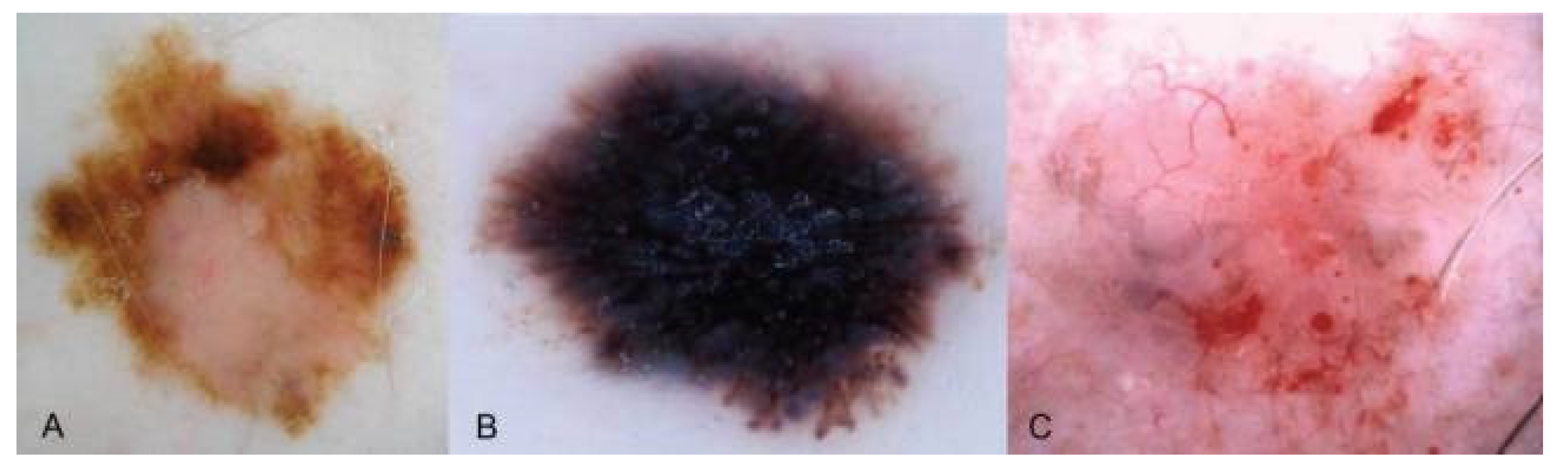 Dermatopathology 09 00039 g003 Dermatopathology 09 00039 g003