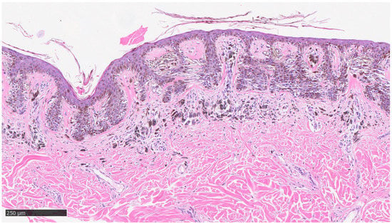 Dermatopathology | Free Full-Text | Is It Time to Supersede the ...