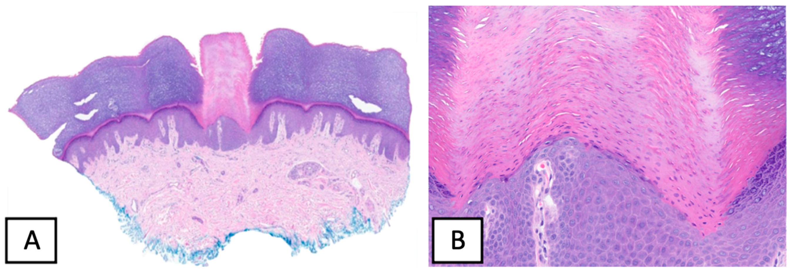 Dermatopathology 10 00021 g002 Dermatopathology 10 00021 g002