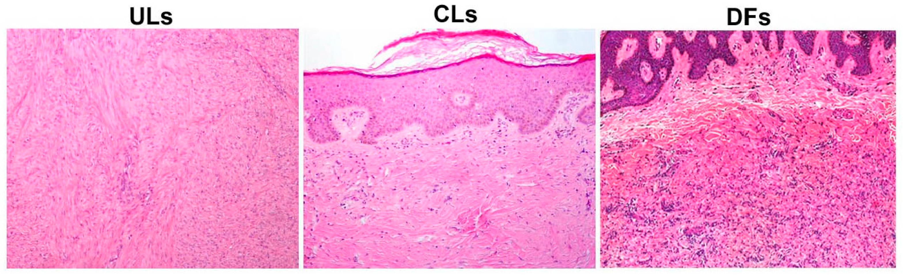 Dermatopathology | Free Full-Text | Increased Occurrence of