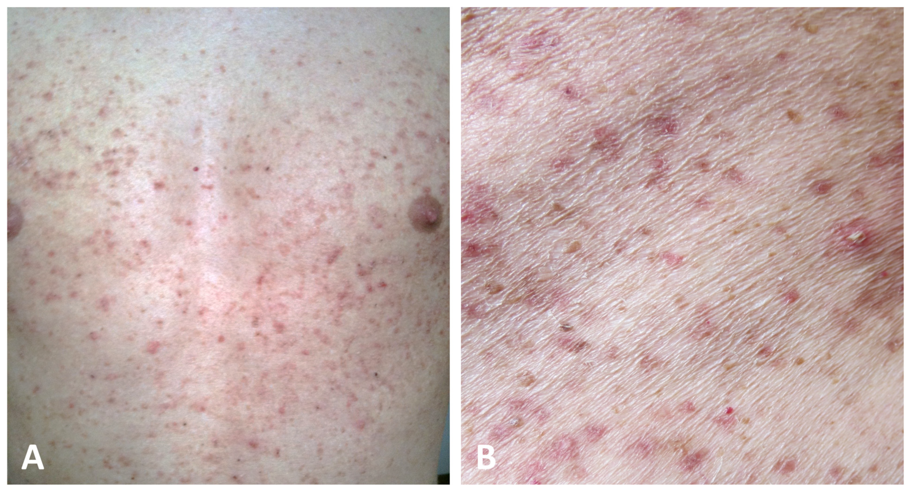 Dermatopathology 11 00008 g004 Dermatopathology 11 00008 g004