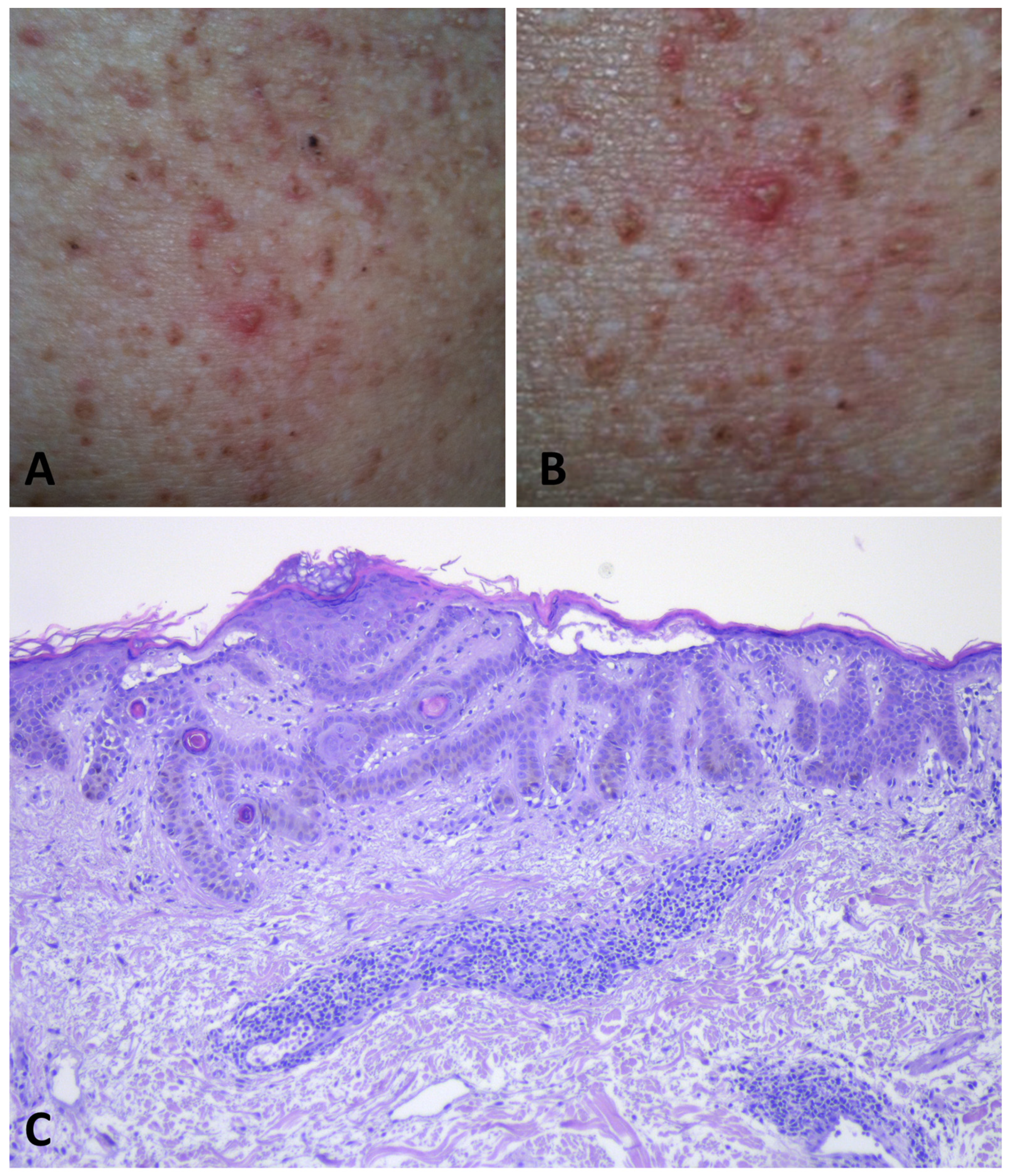 Dermatopathology 11 00008 g005 Dermatopathology 11 00008 g005