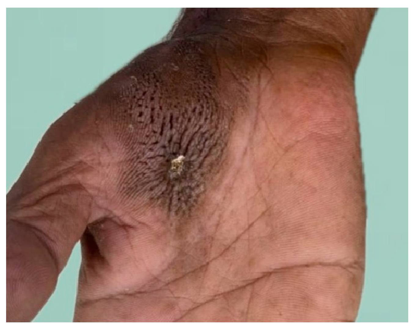 Dermatopathology 11 00030 g002