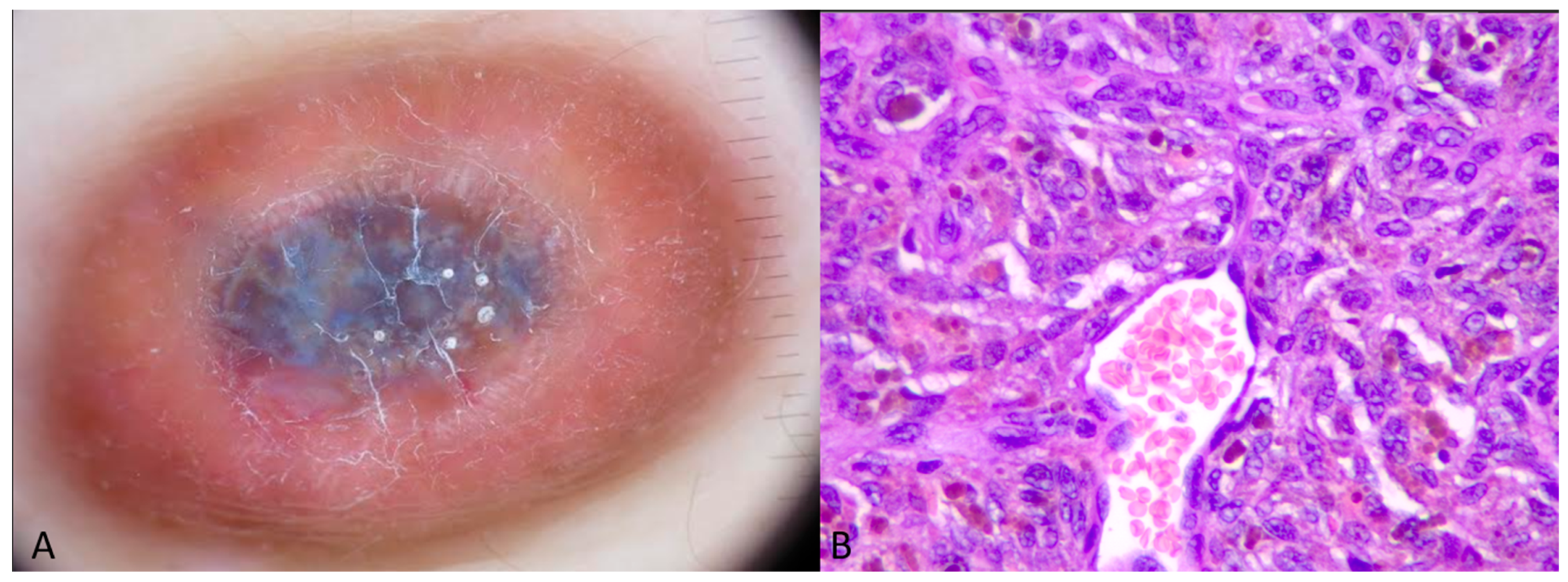 Dermatopathology 11 00035 g002 Dermatopathology 11 00035 g002