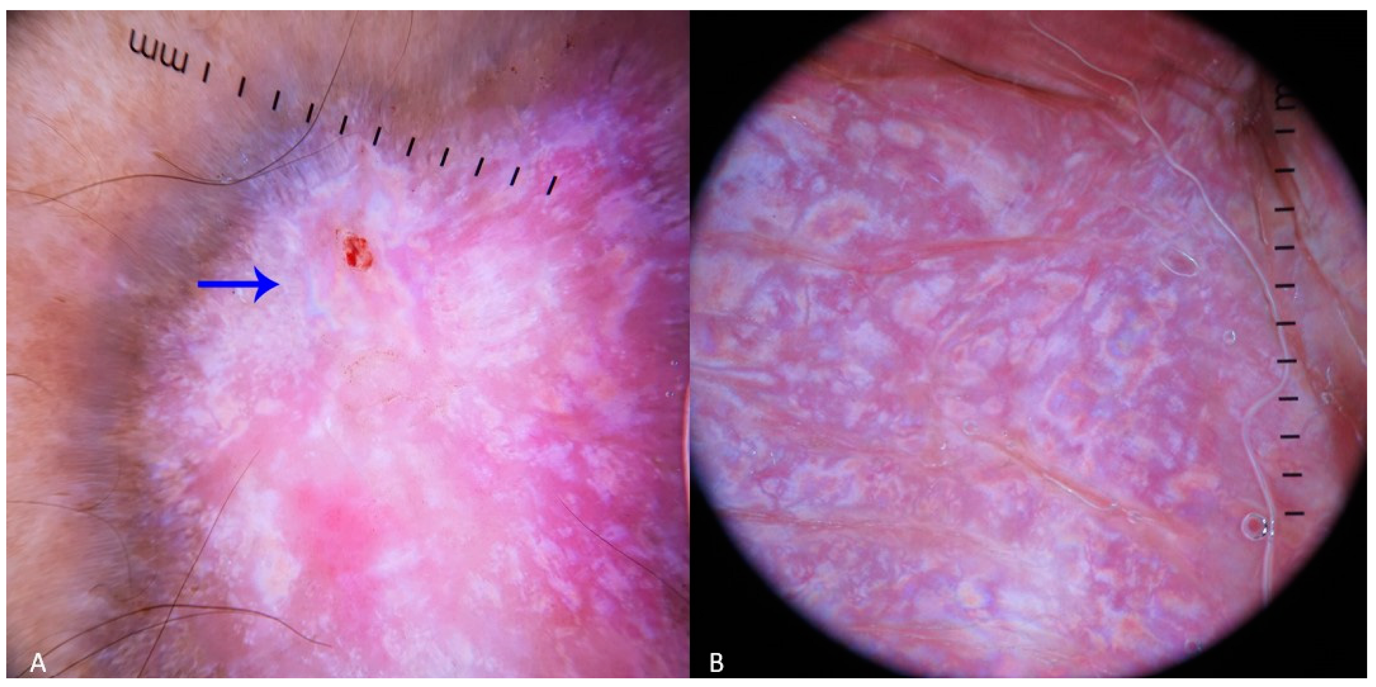 Dermatopathology 11 00035 g003 Dermatopathology 11 00035 g003