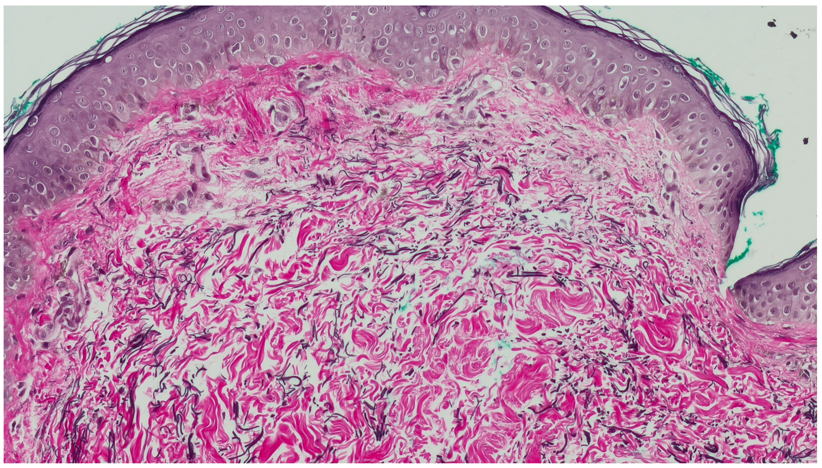 Dermatopathology 12 00015 g003