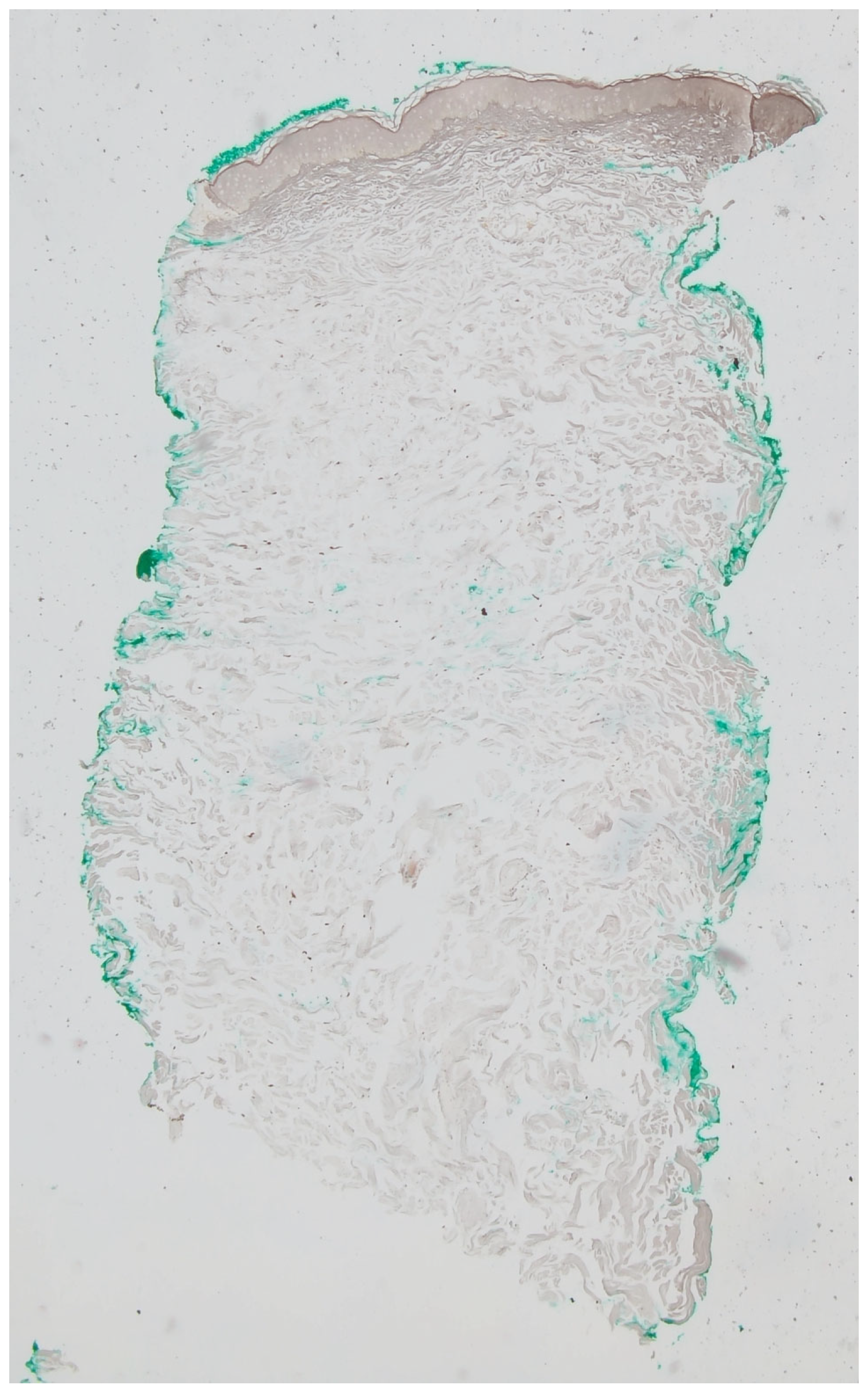 Dermatopathology 12 00015 g004