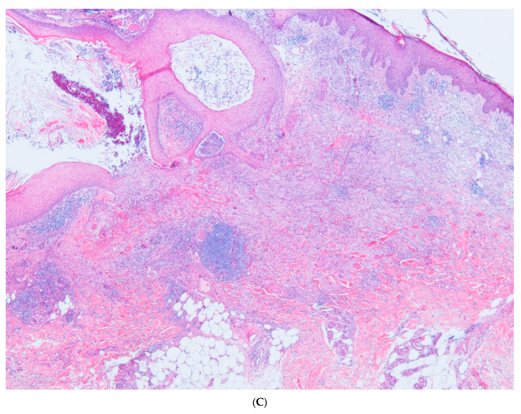 Dermatopathology 12 00016 g002b