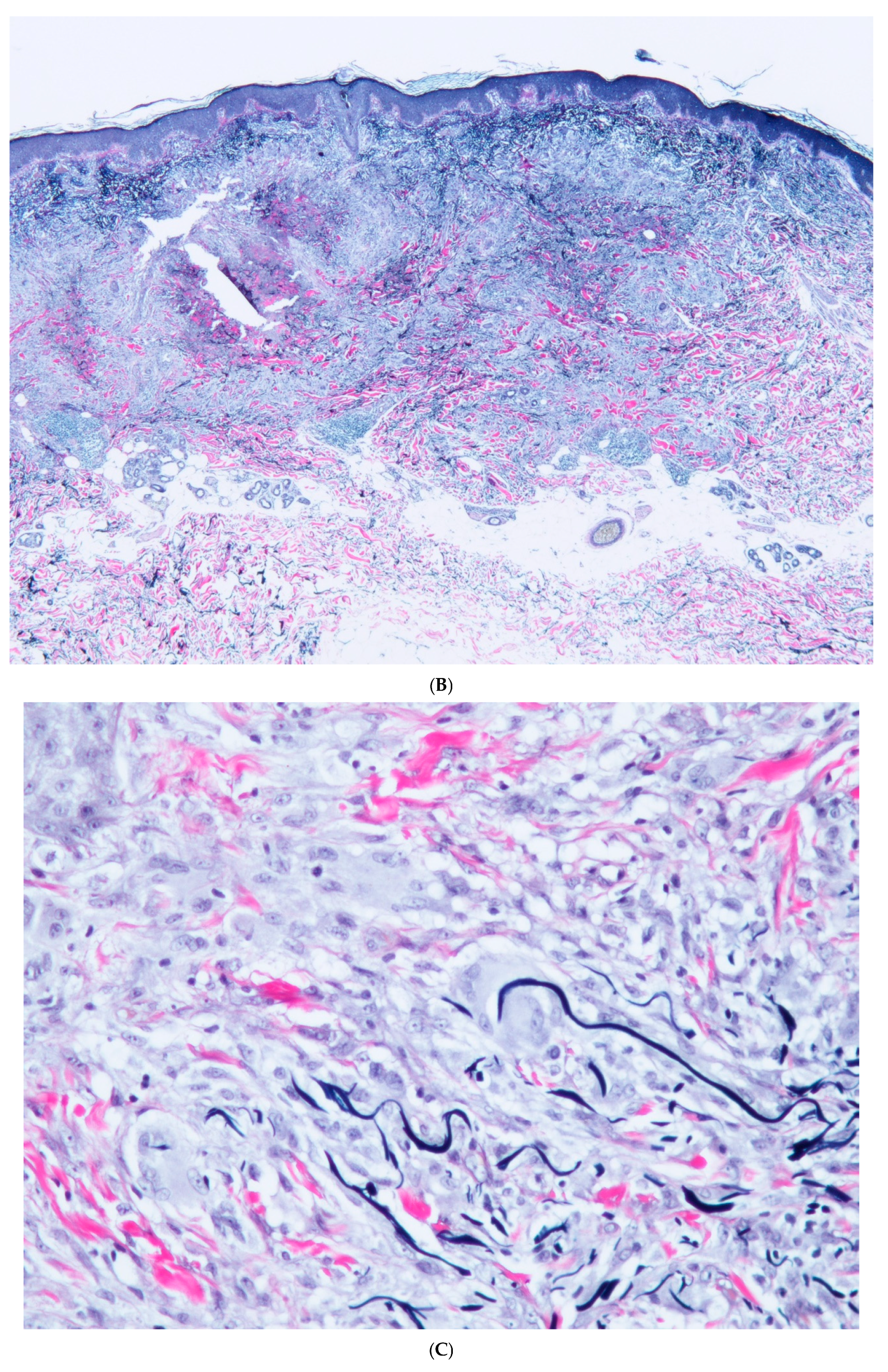 Dermatopathology 12 00016 g003b