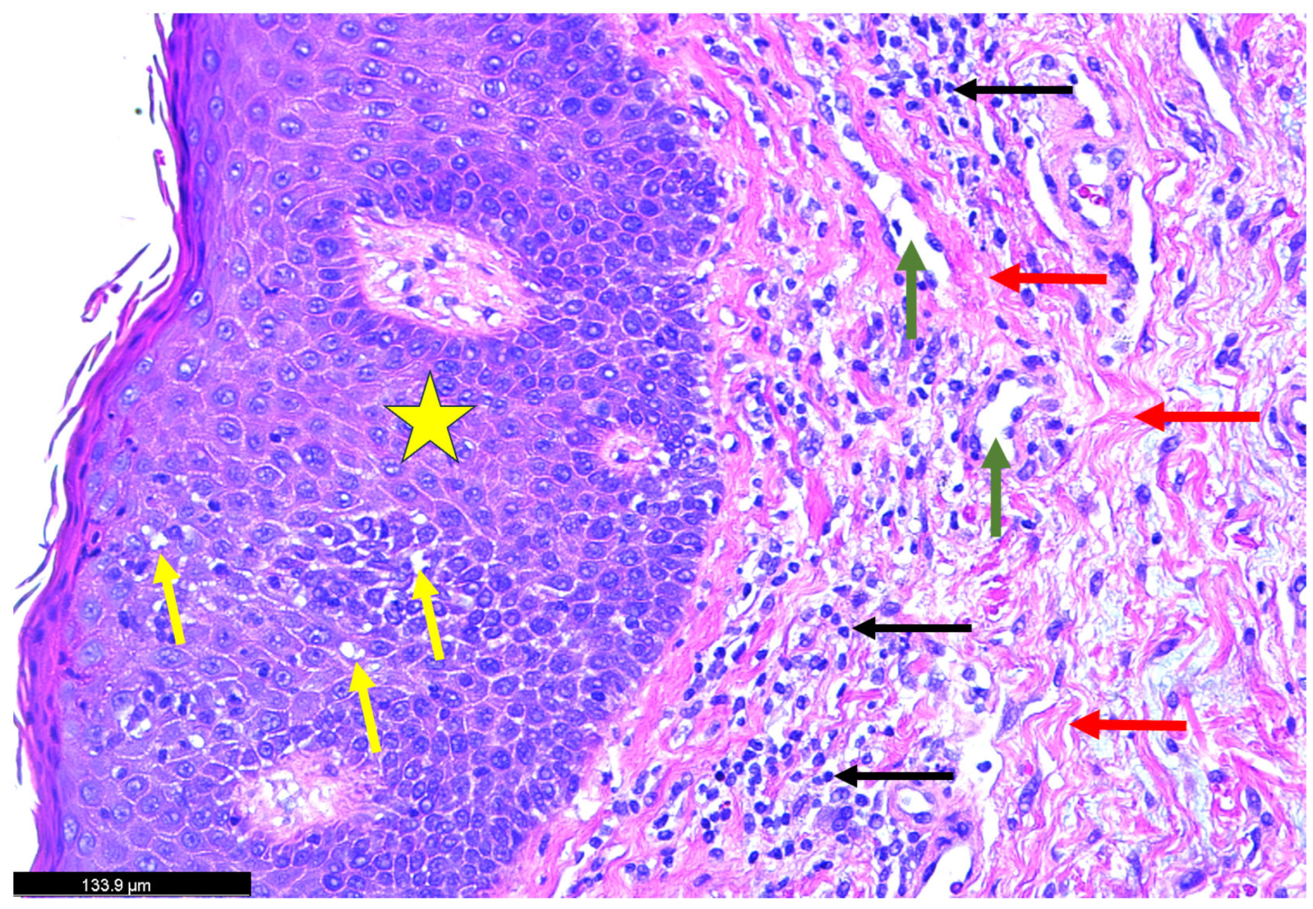 Dermatopathology 12 00017 g002