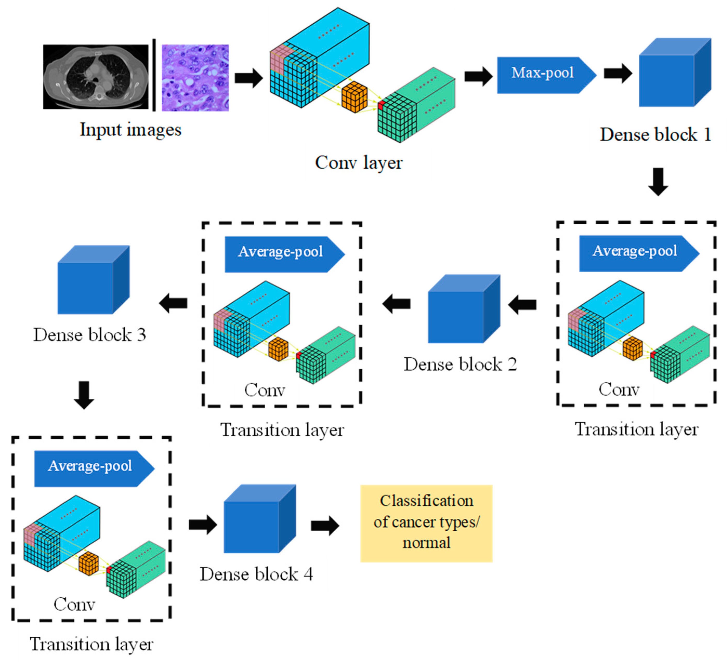 Designs | Free Full-Text | Attention-Based DenseNet for Lung Cancer ...