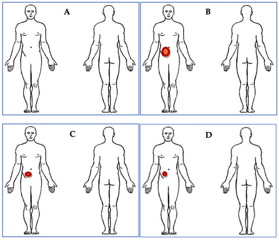 https://www.mdpi.com/diabetology/diabetology-04-00013/article_deploy/html/images/diabetology-04-00013-g001-550.jpg