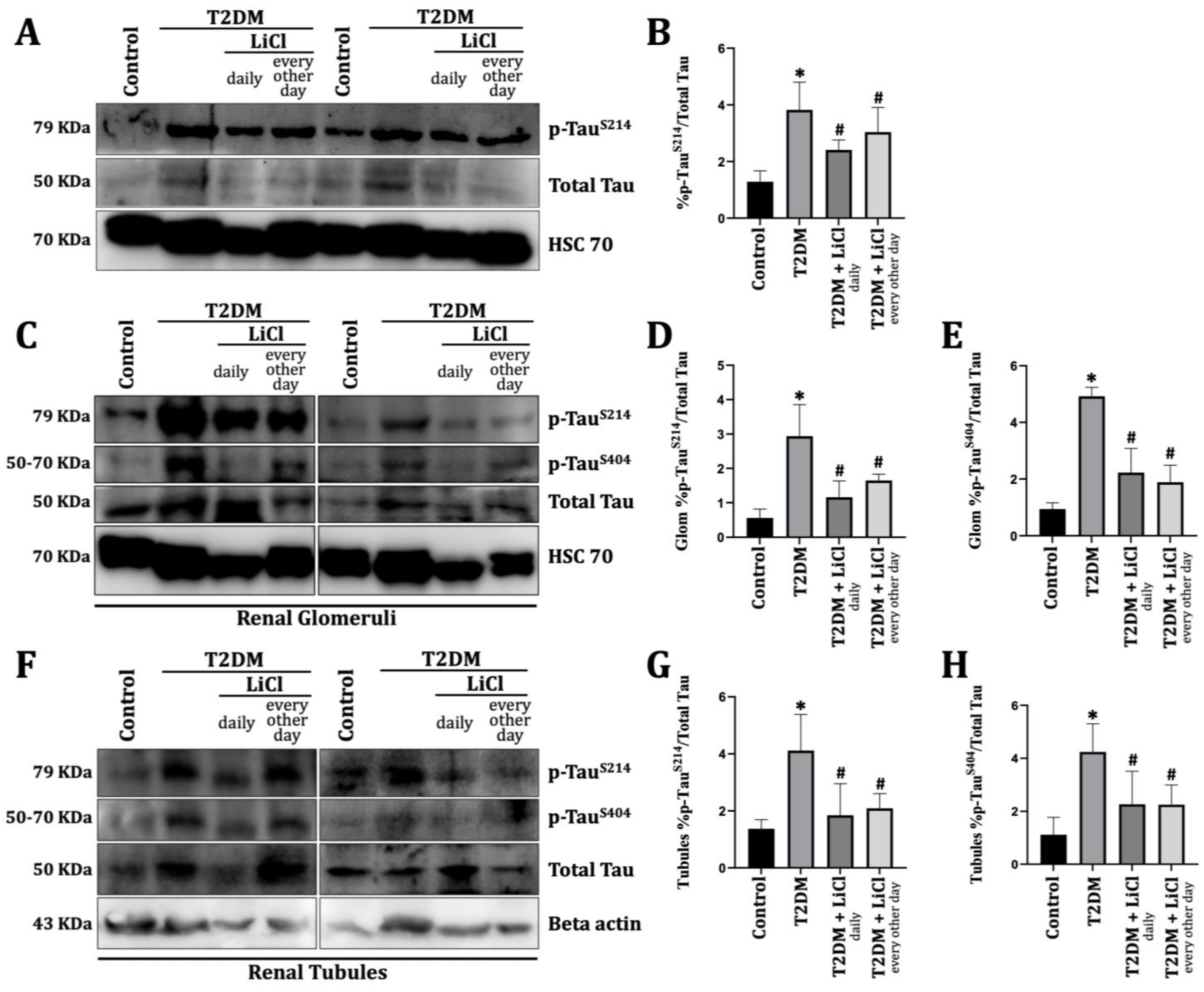 Diabetology 06 00026 g001 Diabetology 06 00026 g001