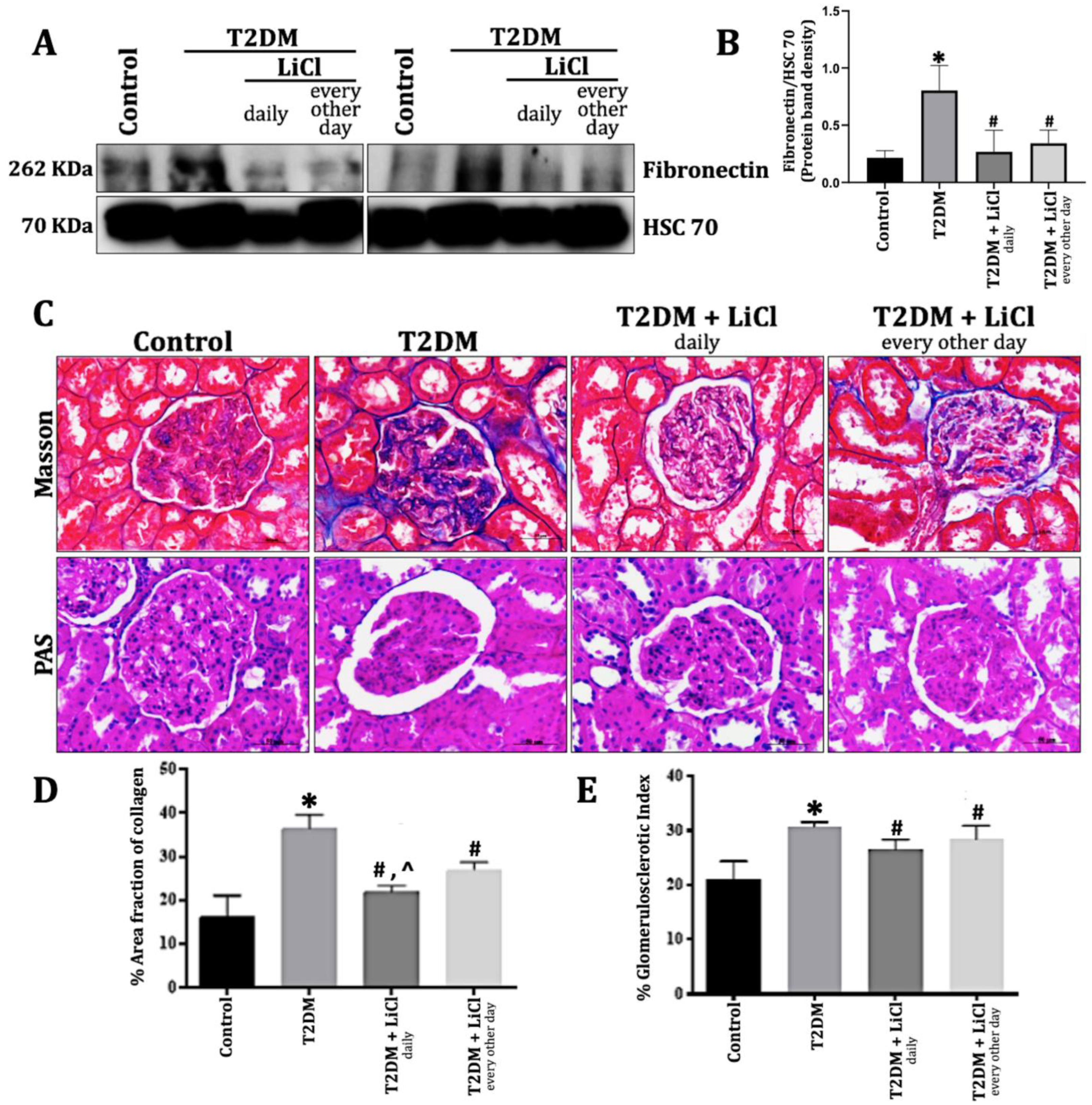 Diabetology 06 00026 g002 Diabetology 06 00026 g002