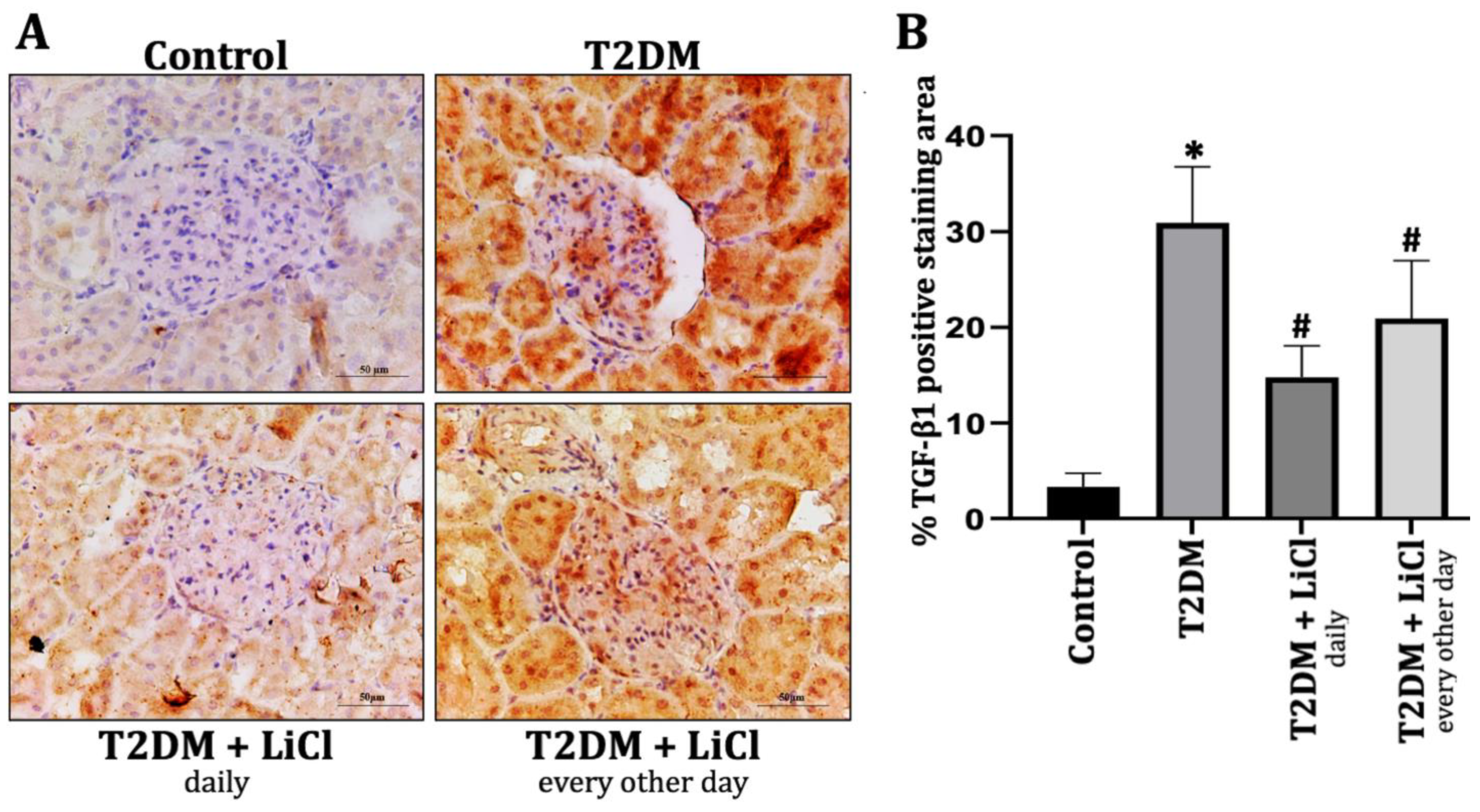 Diabetology 06 00026 g003 Diabetology 06 00026 g003