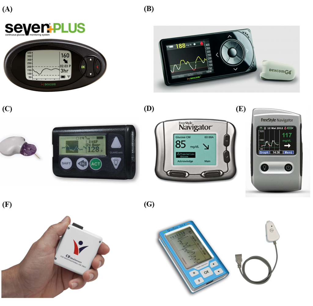 Diagnostics | Free Full-Text | Continuous Glucose Monitoring Systems: A  Review