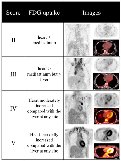 Diagnostics | Free Full-Text | A Score-Based Approach to 18F-FDG PET Images  as a Tool to Describe Metabolic Predictors of Myocardial Doxorubicin  Susceptibility