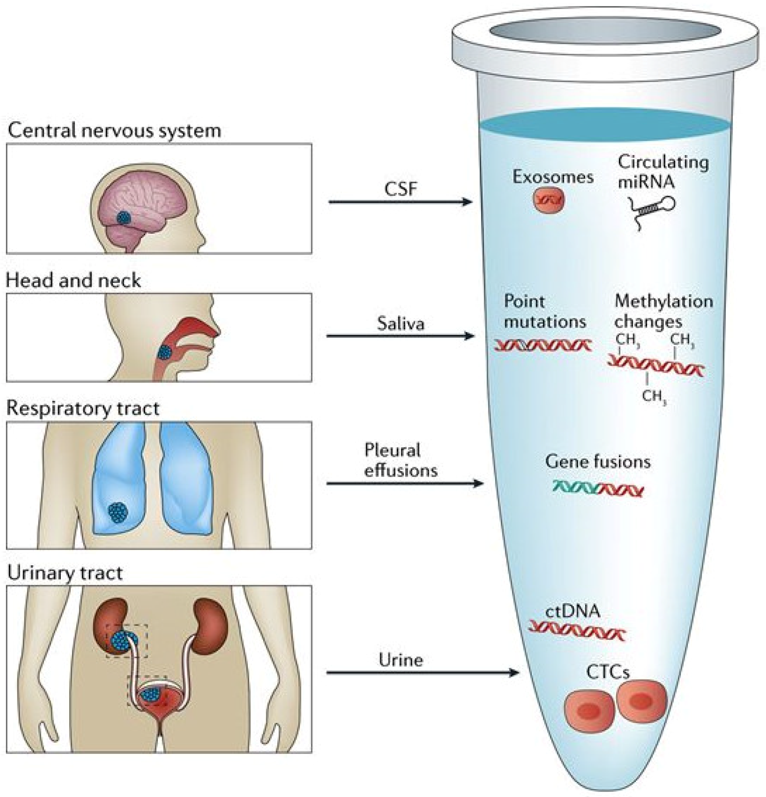 Diagnostics Free FullText Liquid Biopsy in